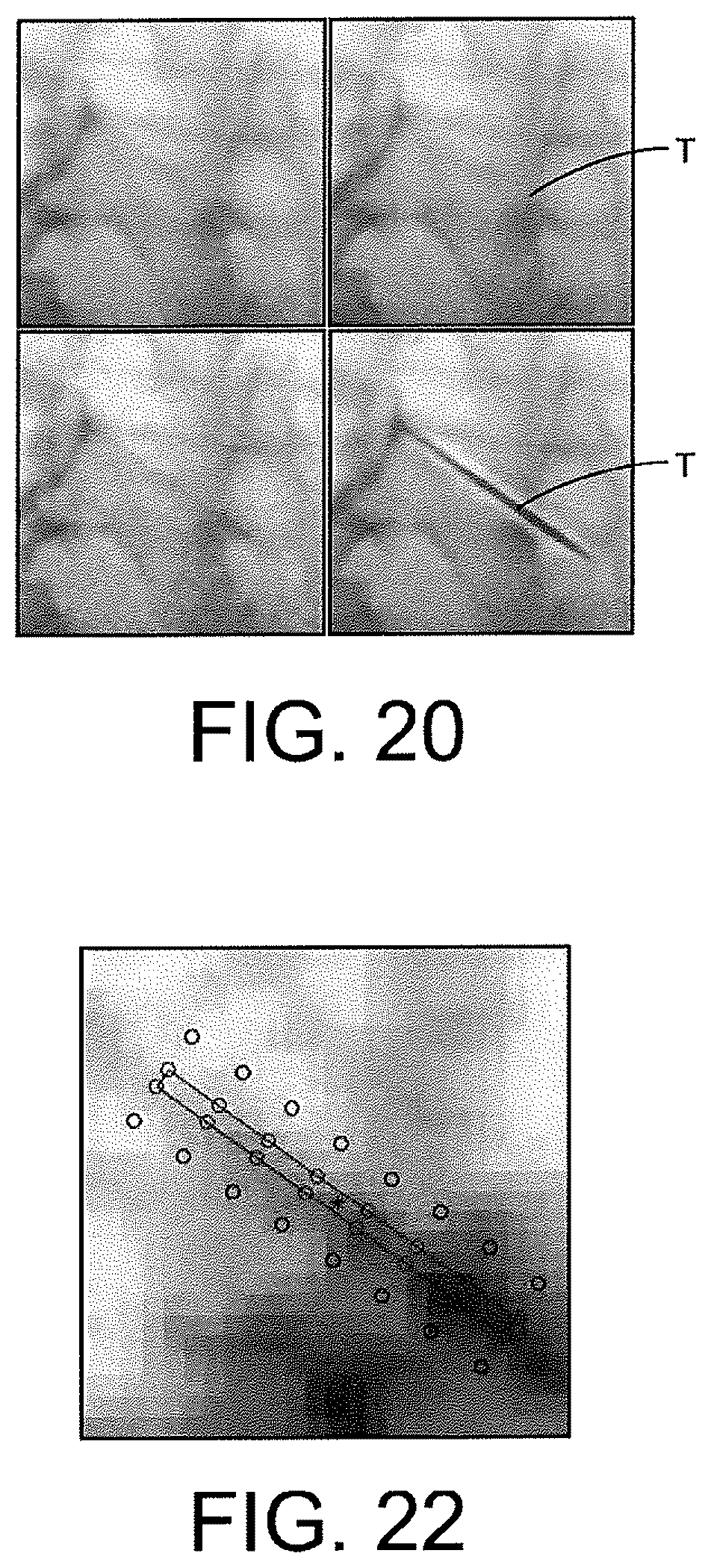 Patent US12508083 Figure 19 – System and method for image localization of effecters during a medical procedure