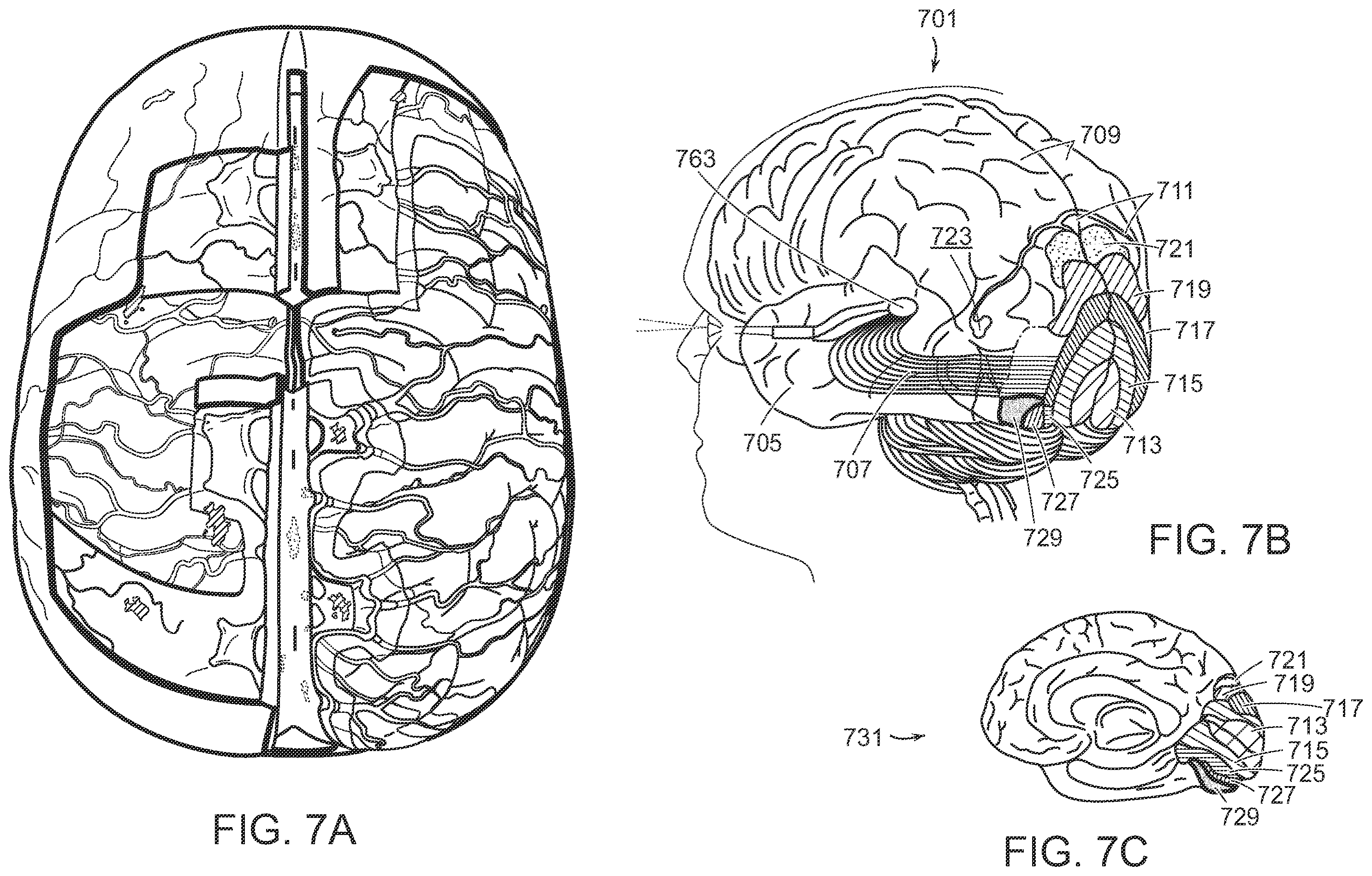 Patent US12508084 Figure 7 – Systems and methods for high-bandwidth minimally invasive brain-computer interfaces