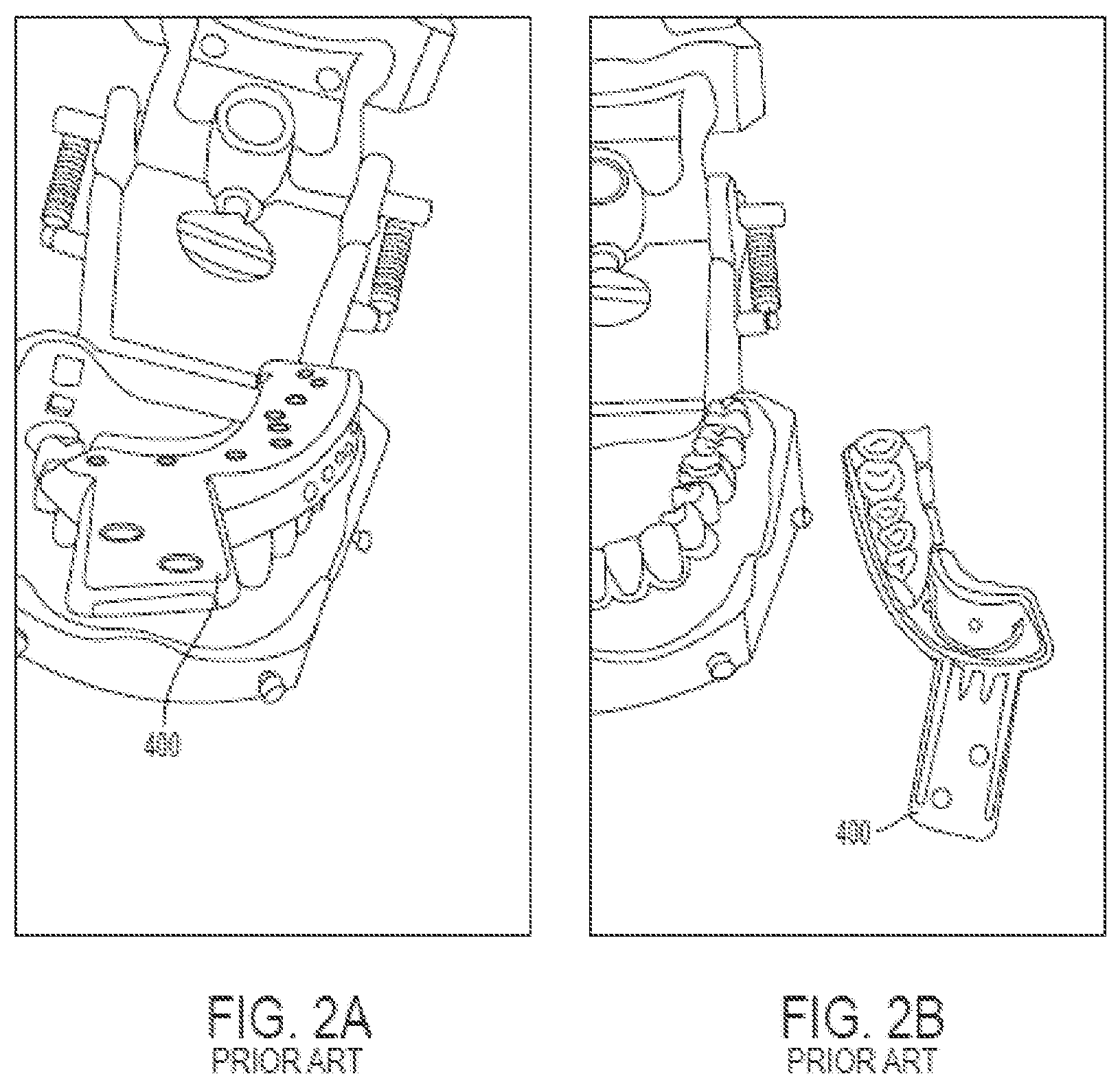 Patent US12508087 Figure 2 – Splint device for guided surgical robot
