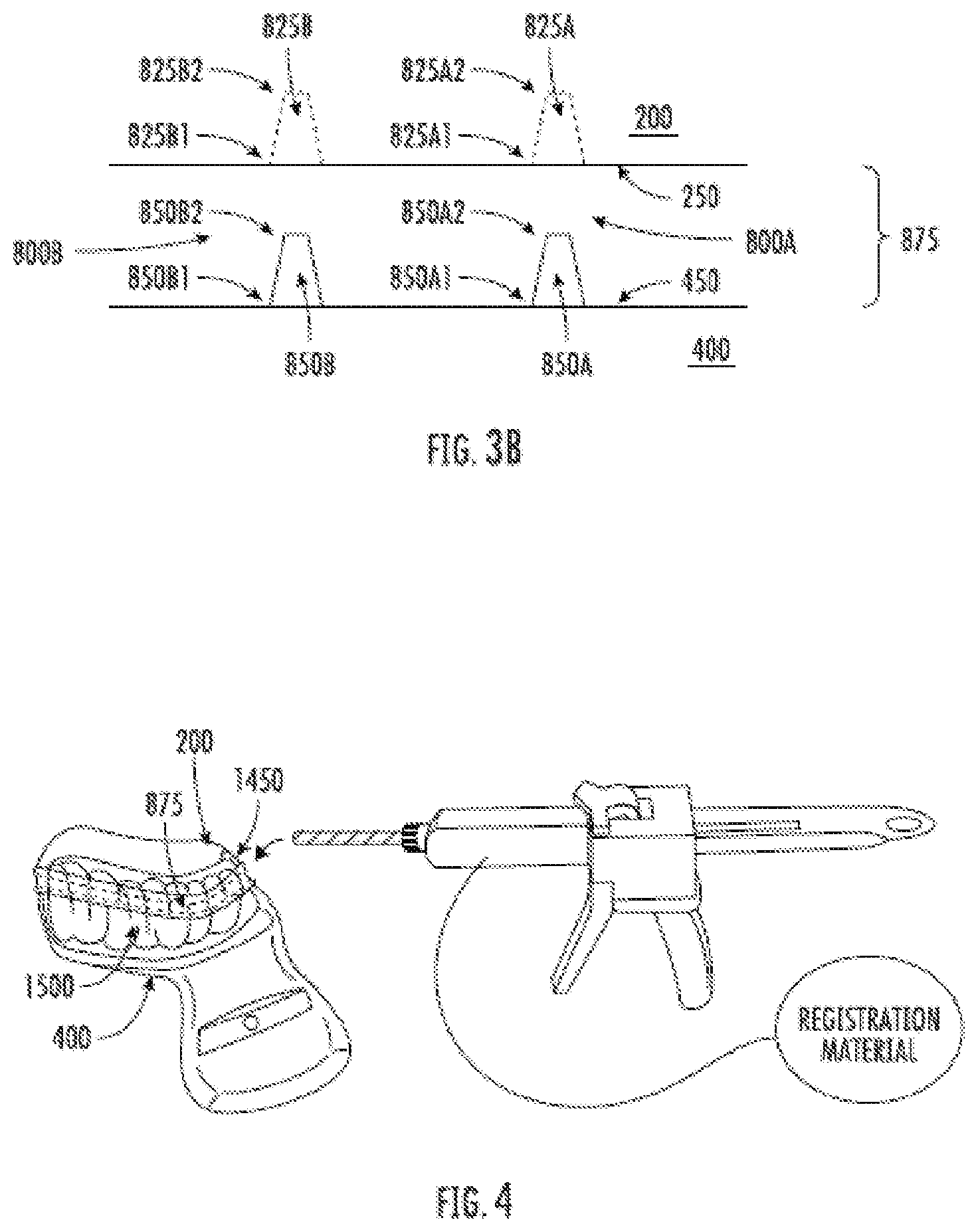 Patent US12508087 Figure 4 – Splint device for guided surgical robot