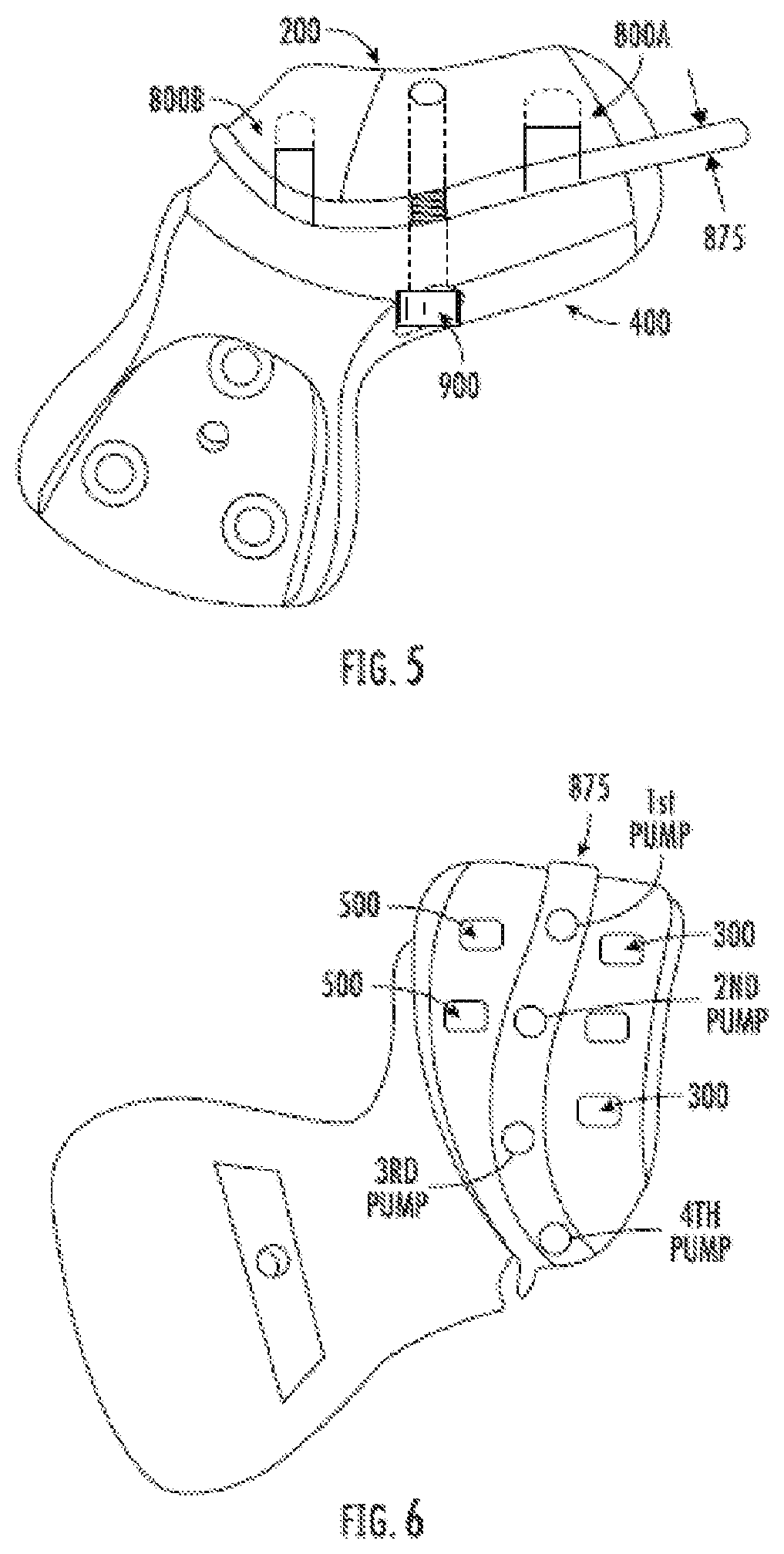 Patent US12508087 Figure 5 – Splint device for guided surgical robot