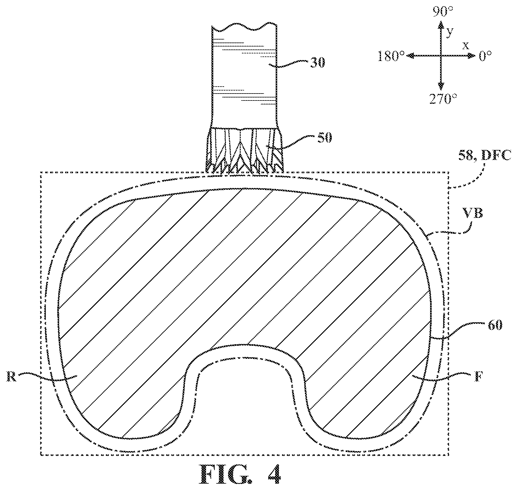 Patent US12508088 Figure 4 – Selectively automated robotic surgical system