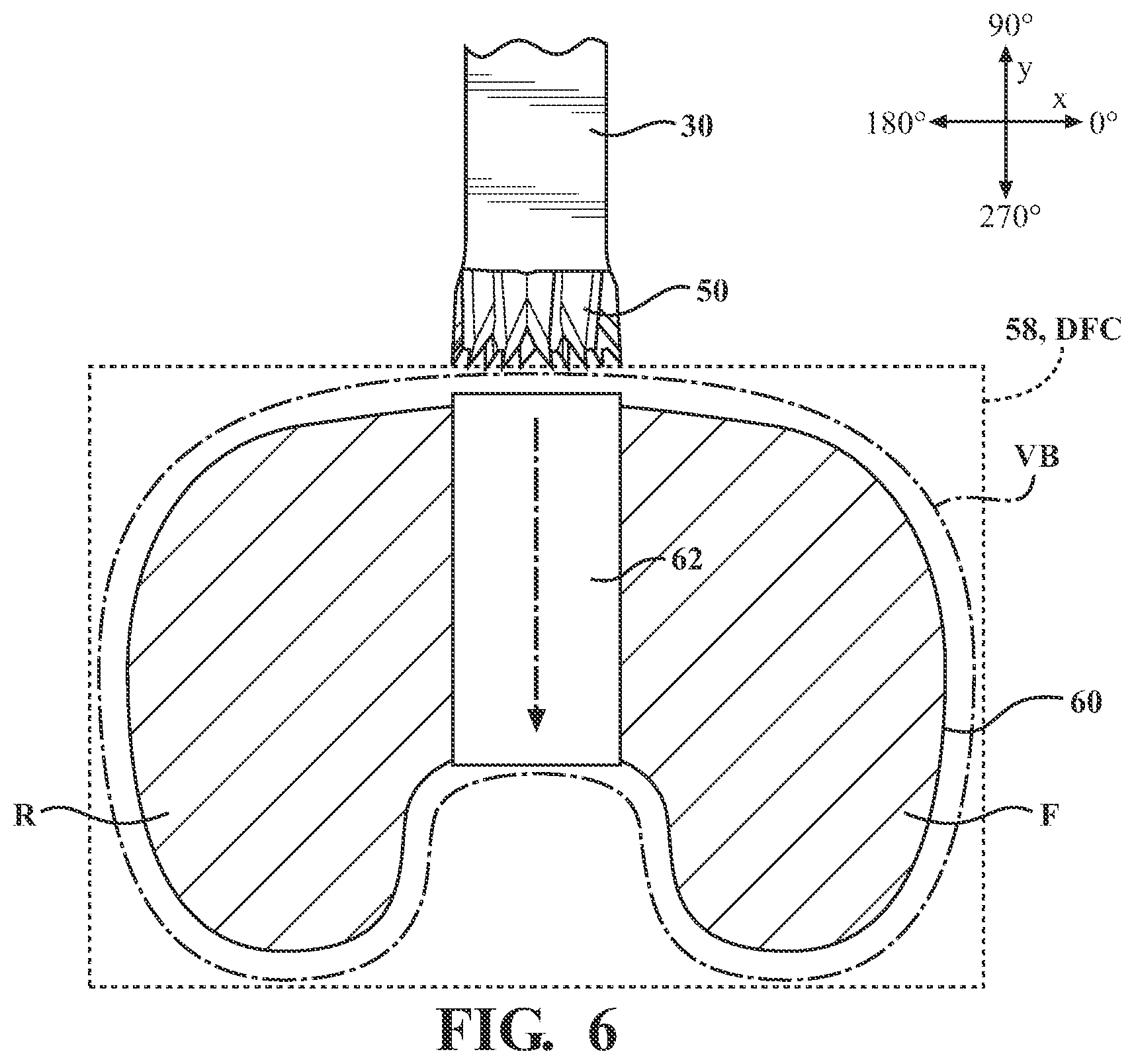 Patent US12508088 Figure 6 – Selectively automated robotic surgical system