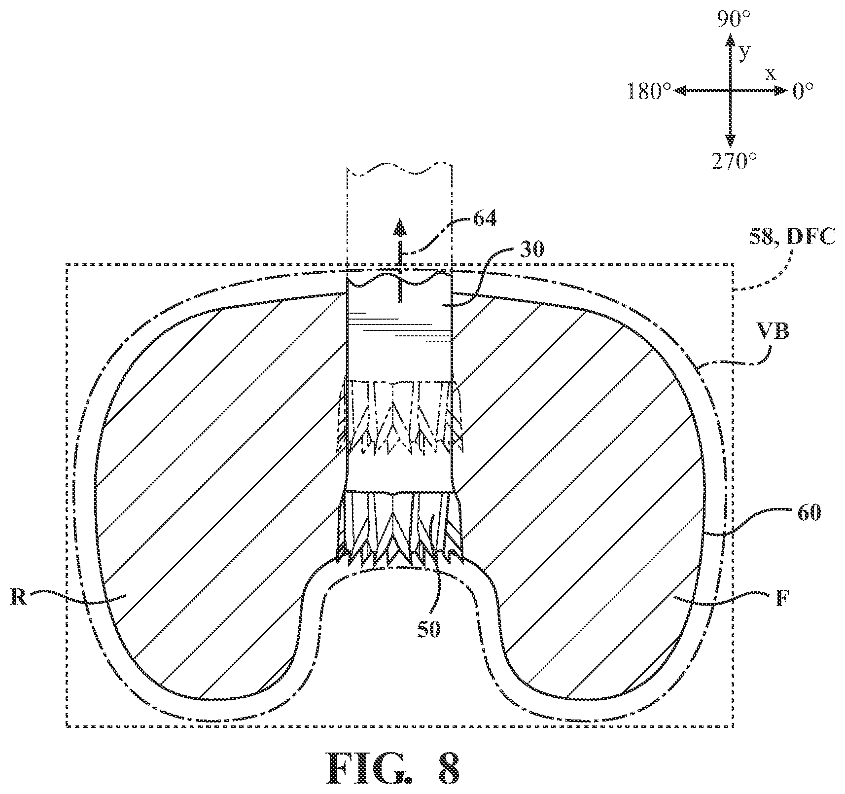 Patent US12508088 Figure 8 – Selectively automated robotic surgical system