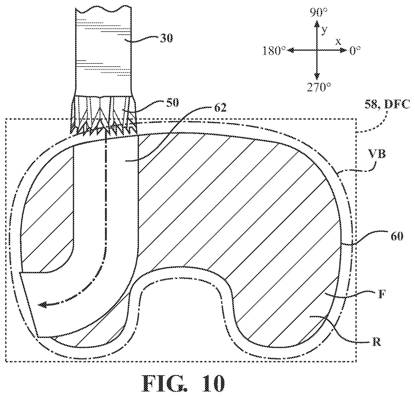 Patent US12508088 Figure 10 – Selectively automated robotic surgical system