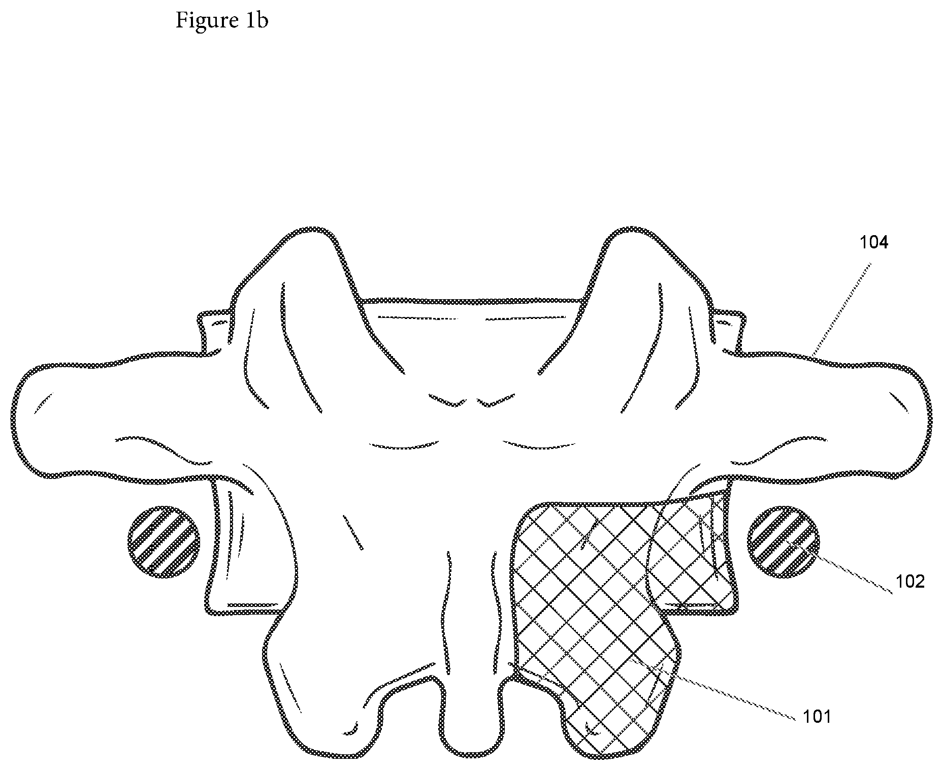 Patent US12508090 Figure 2 – Synchronized robotic bone milling