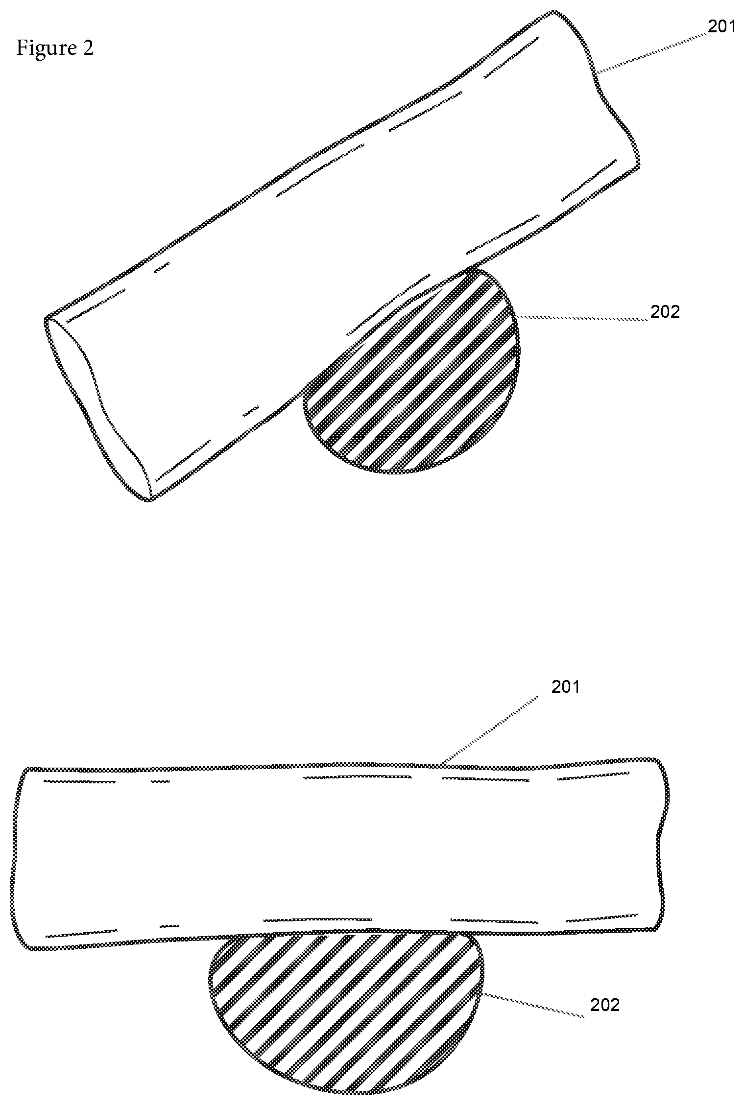 Patent US12508090 Figure 4 – Synchronized robotic bone milling