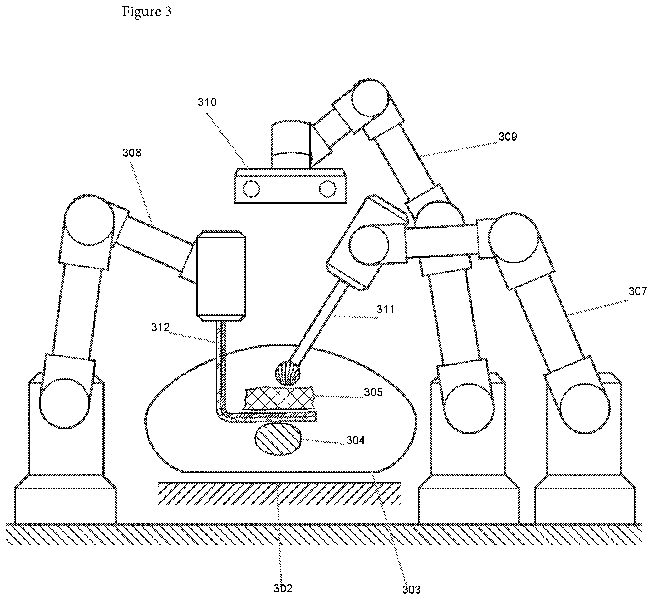 Patent US12508090 Figure 5 – Synchronized robotic bone milling