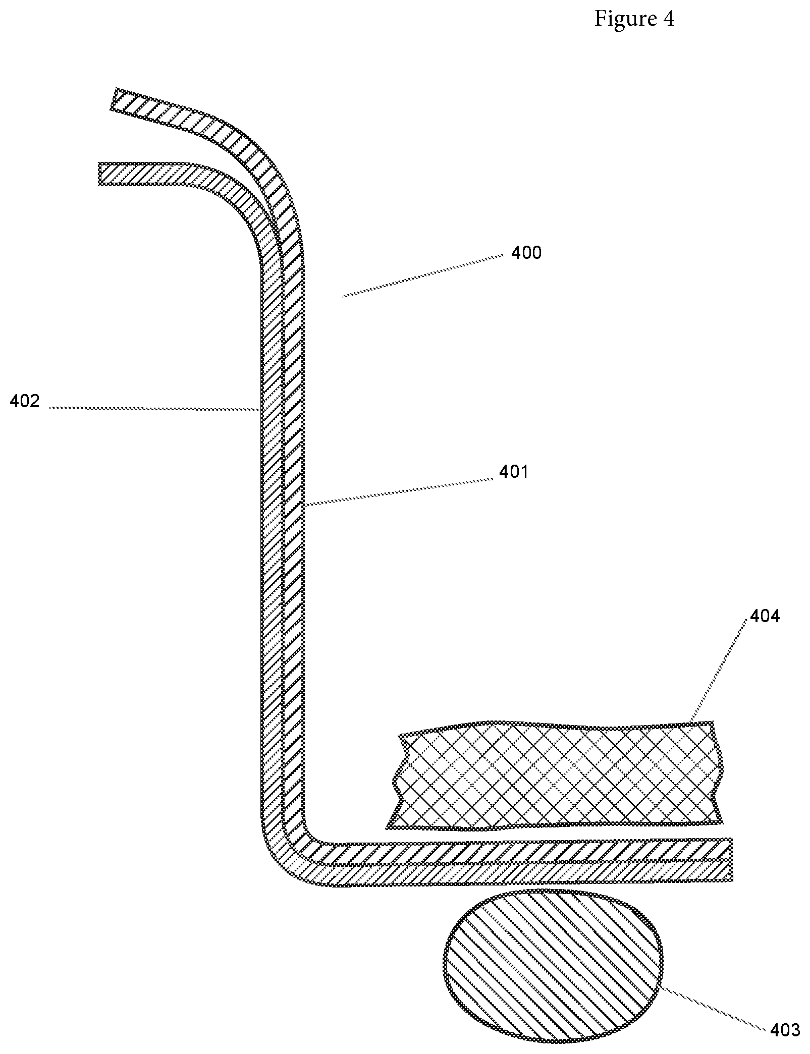Patent US12508090 Figure 6 – Synchronized robotic bone milling