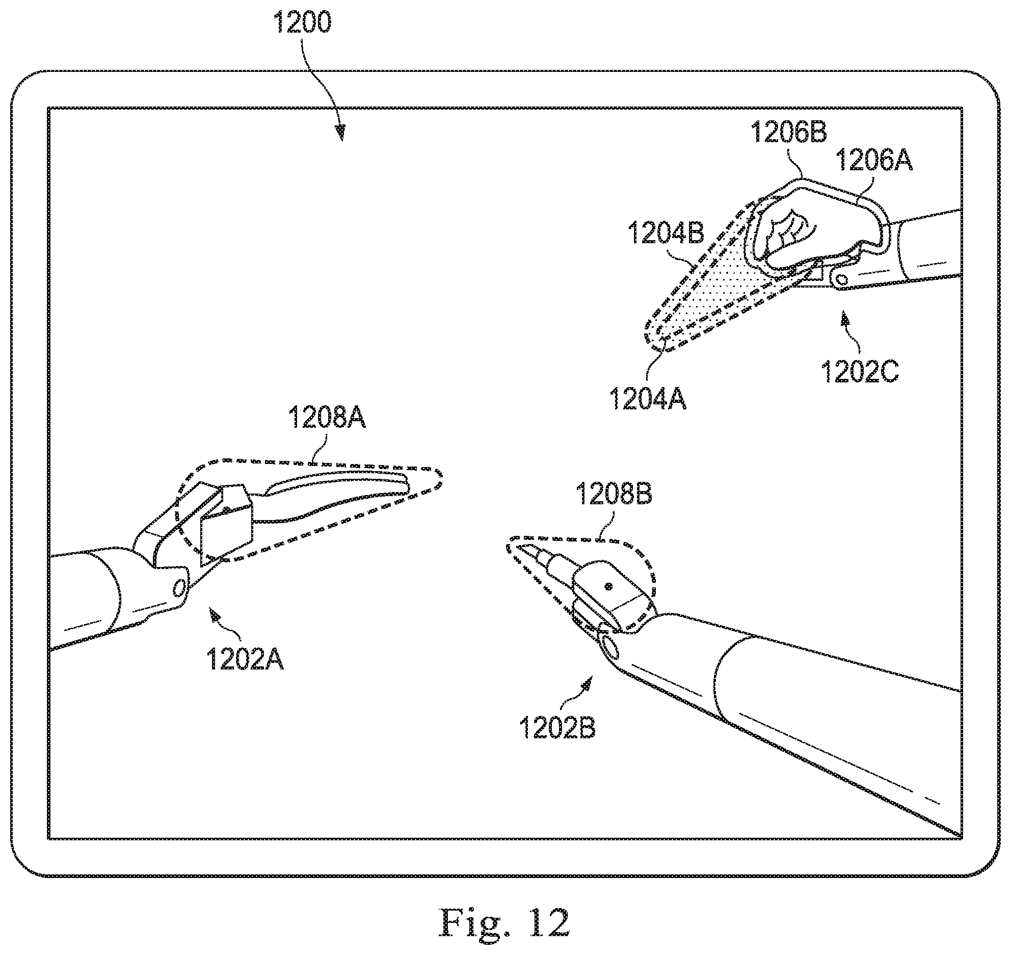 Patent US12508091 Figure 15 – Systems and methods for switching control between multiple instrument arms