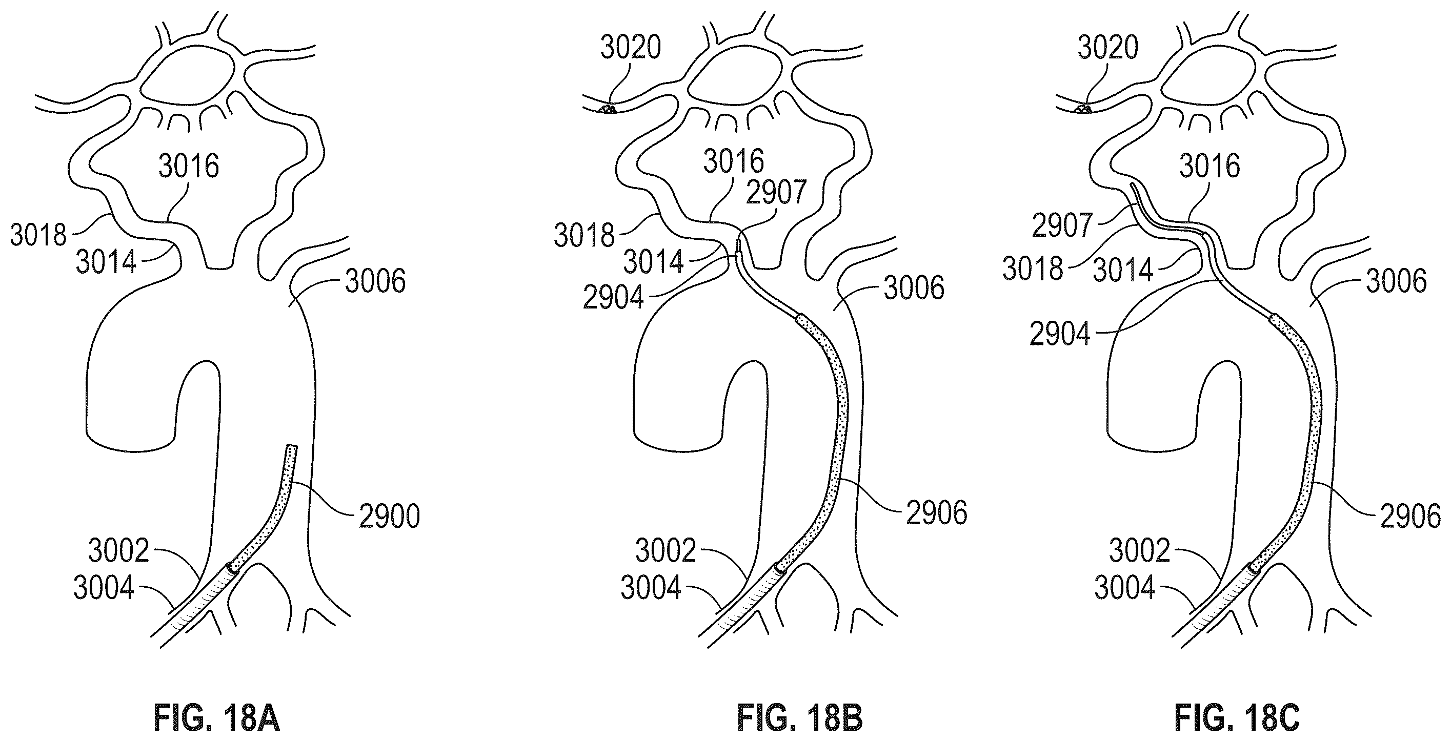 Patent US12508093 Figure 20 – Magnetic coupling through a sterile field barrier