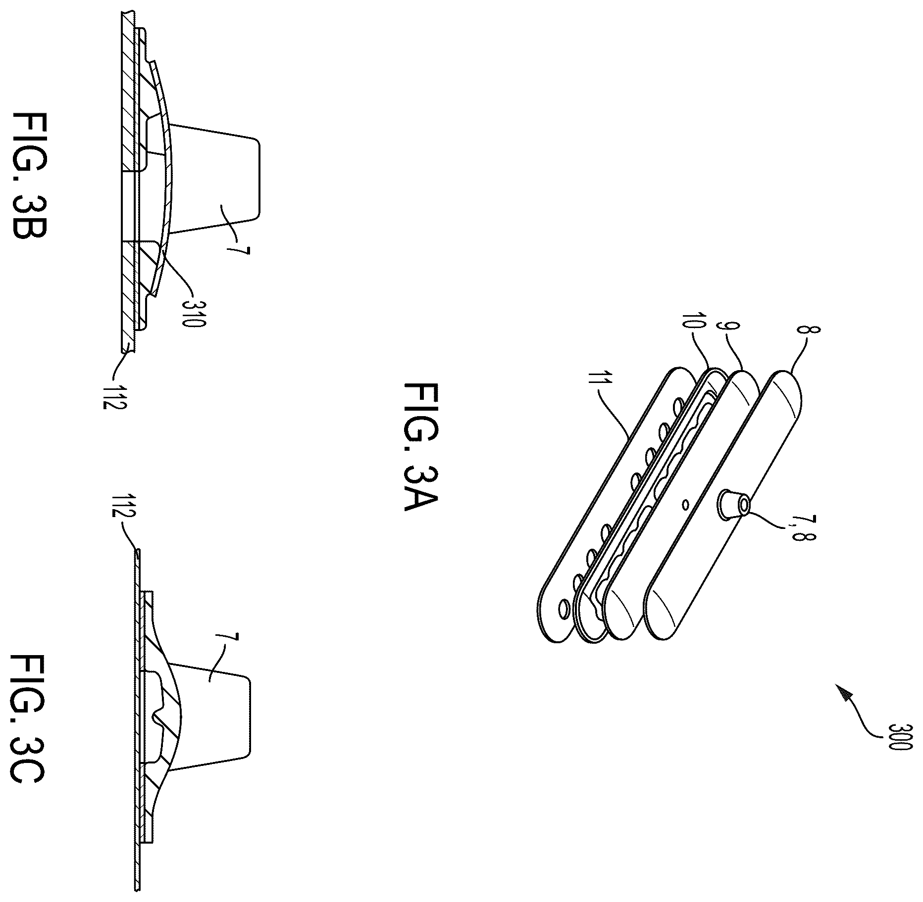 Patent US12508096 Figure 3 – Systems and methods for tissue expansion