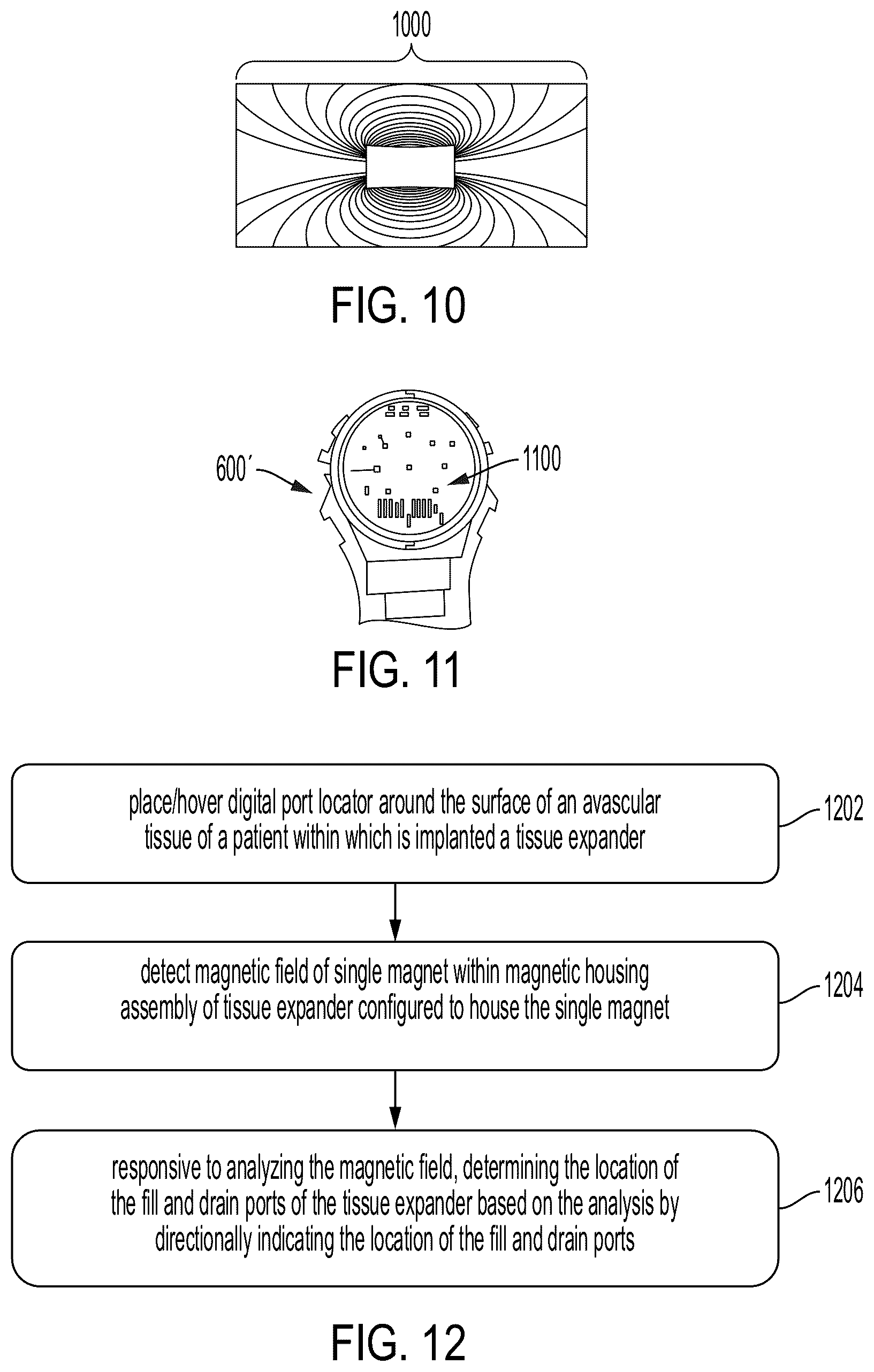 Patent US12508096 Figure 7 – Systems and methods for tissue expansion