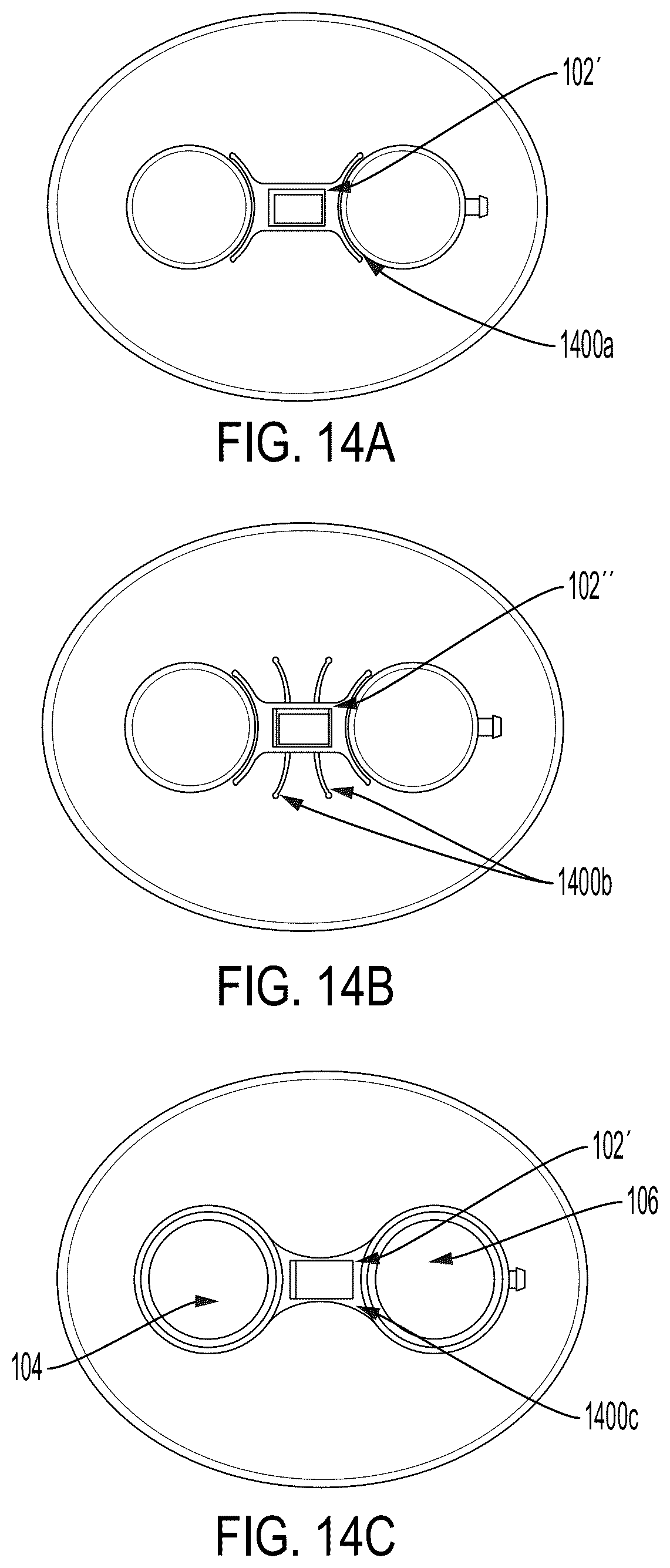 Patent US12508096 Figure 9 – Systems and methods for tissue expansion