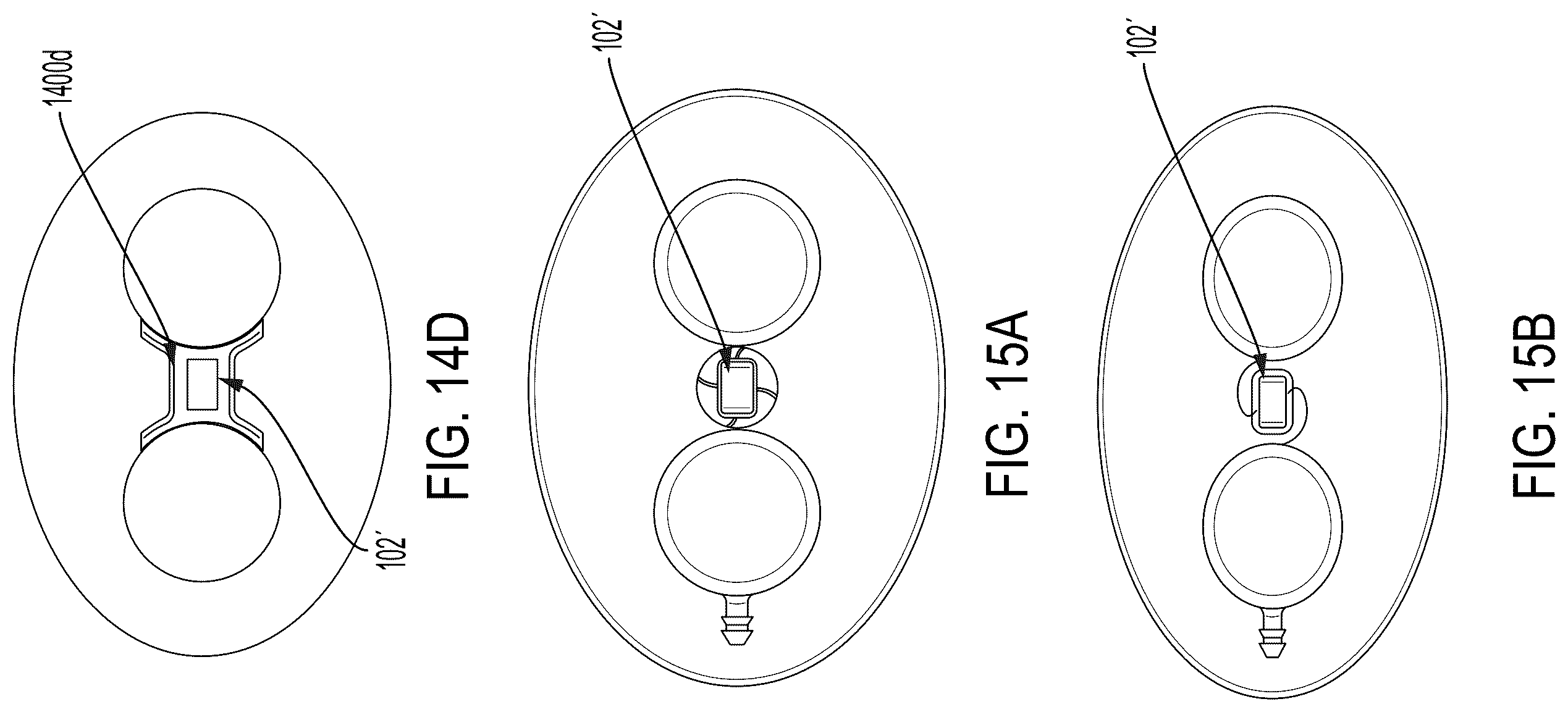 Patent US12508096 Figure 10 – Systems and methods for tissue expansion