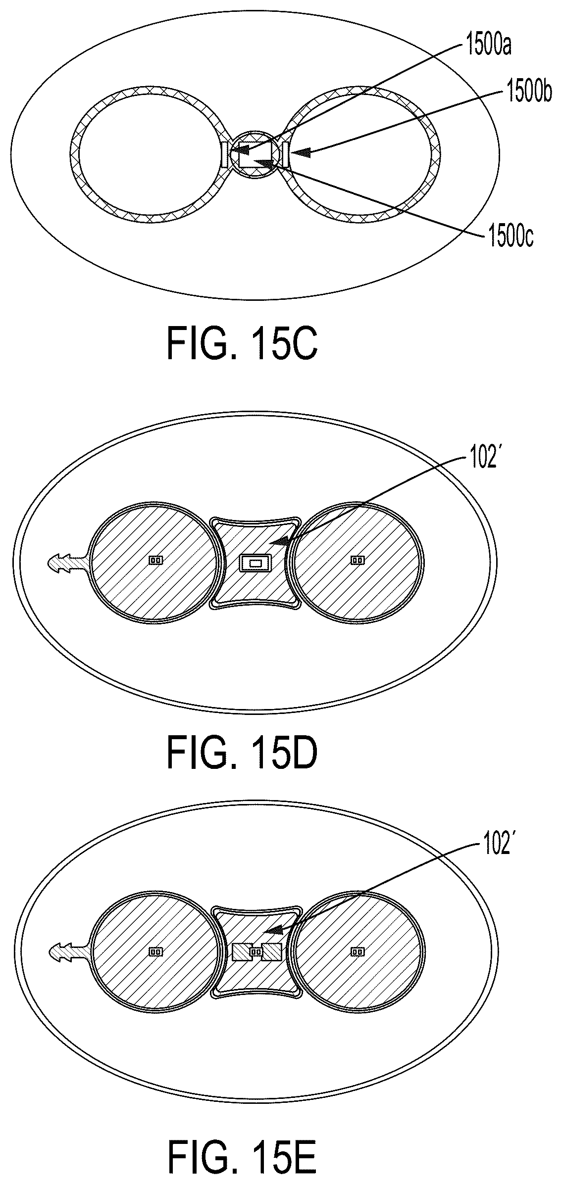 Patent US12508096 Figure 11 – Systems and methods for tissue expansion