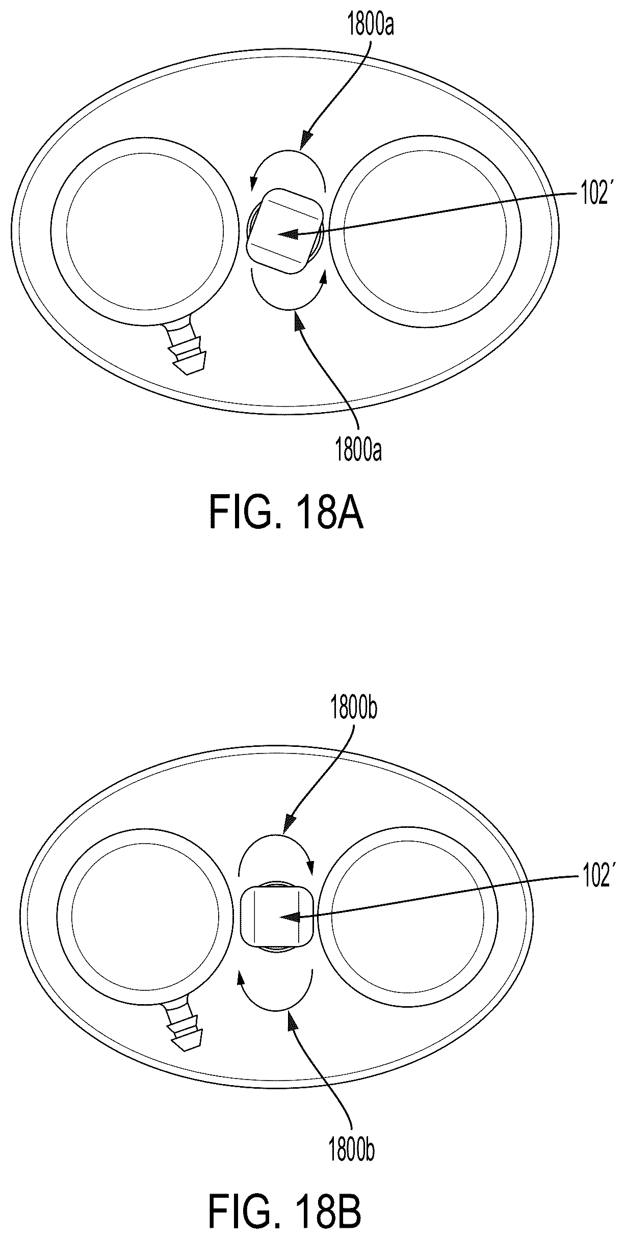 Patent US12508096 Figure 14 – Systems and methods for tissue expansion