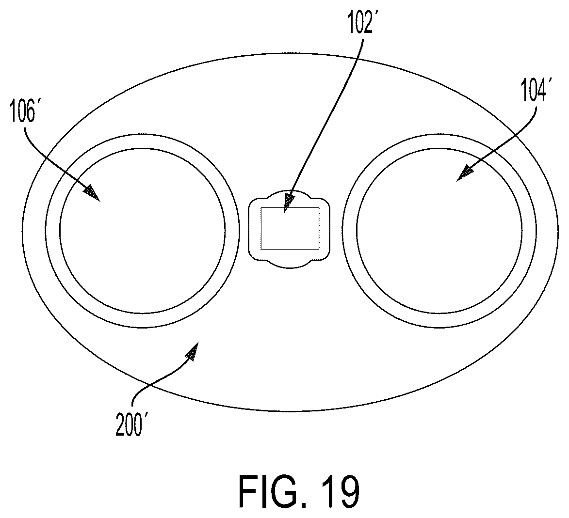 Patent US12508096 Figure 15 – Systems and methods for tissue expansion