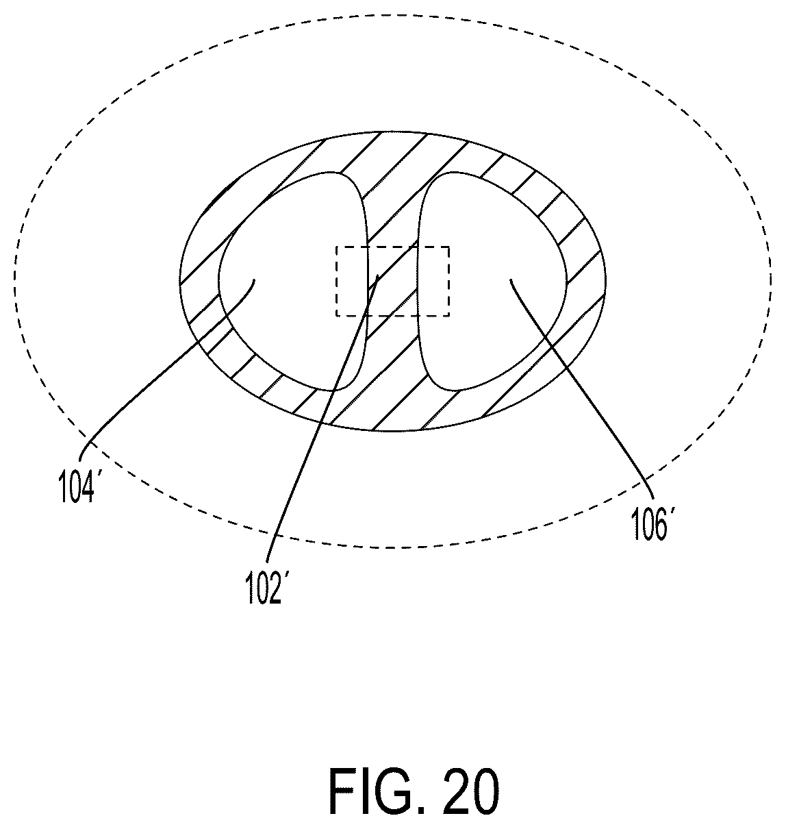 Patent US12508096 Figure 16 – Systems and methods for tissue expansion