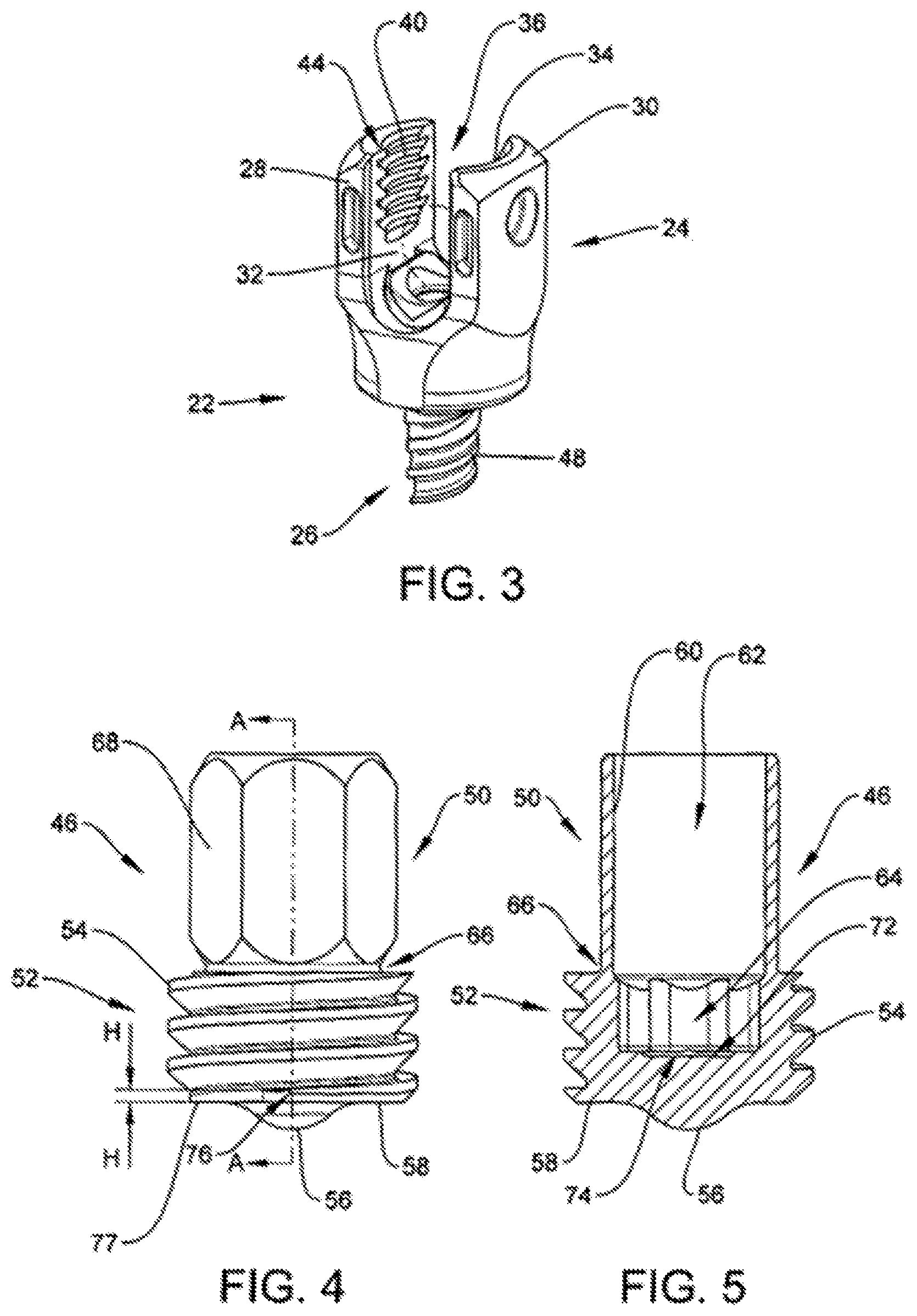 Patent US12508097 Figure 2 – Set screw with strain gauges