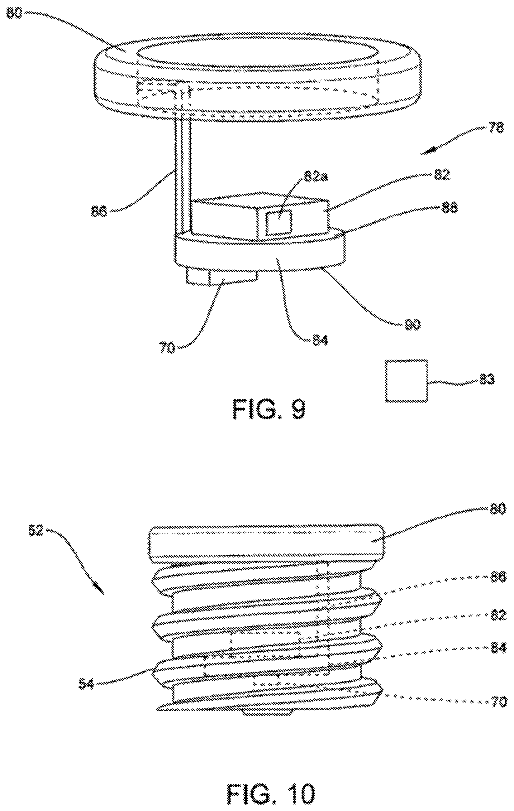 Patent US12508097 Figure 4 – Set screw with strain gauges