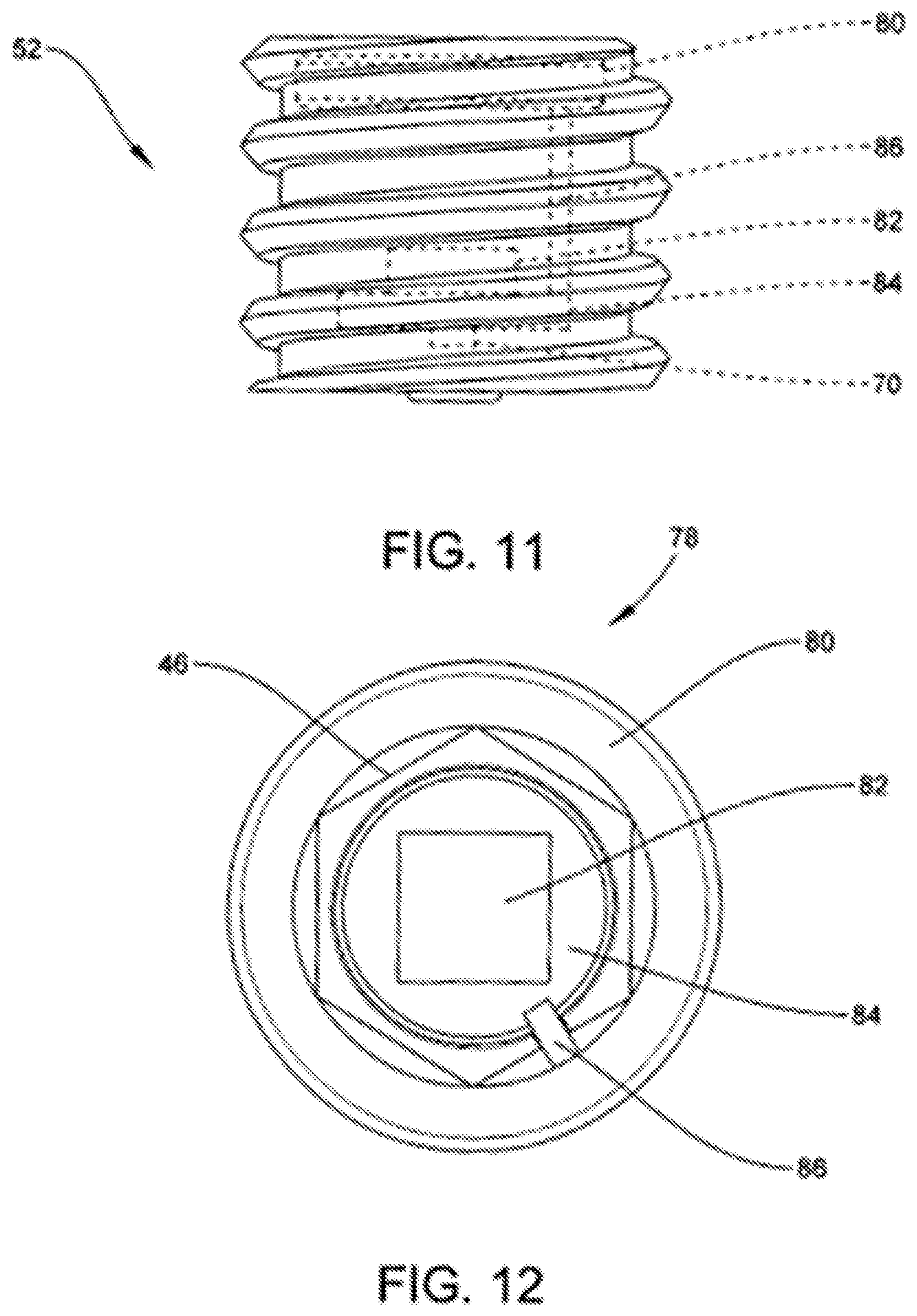 Patent US12508097 Figure 5 – Set screw with strain gauges