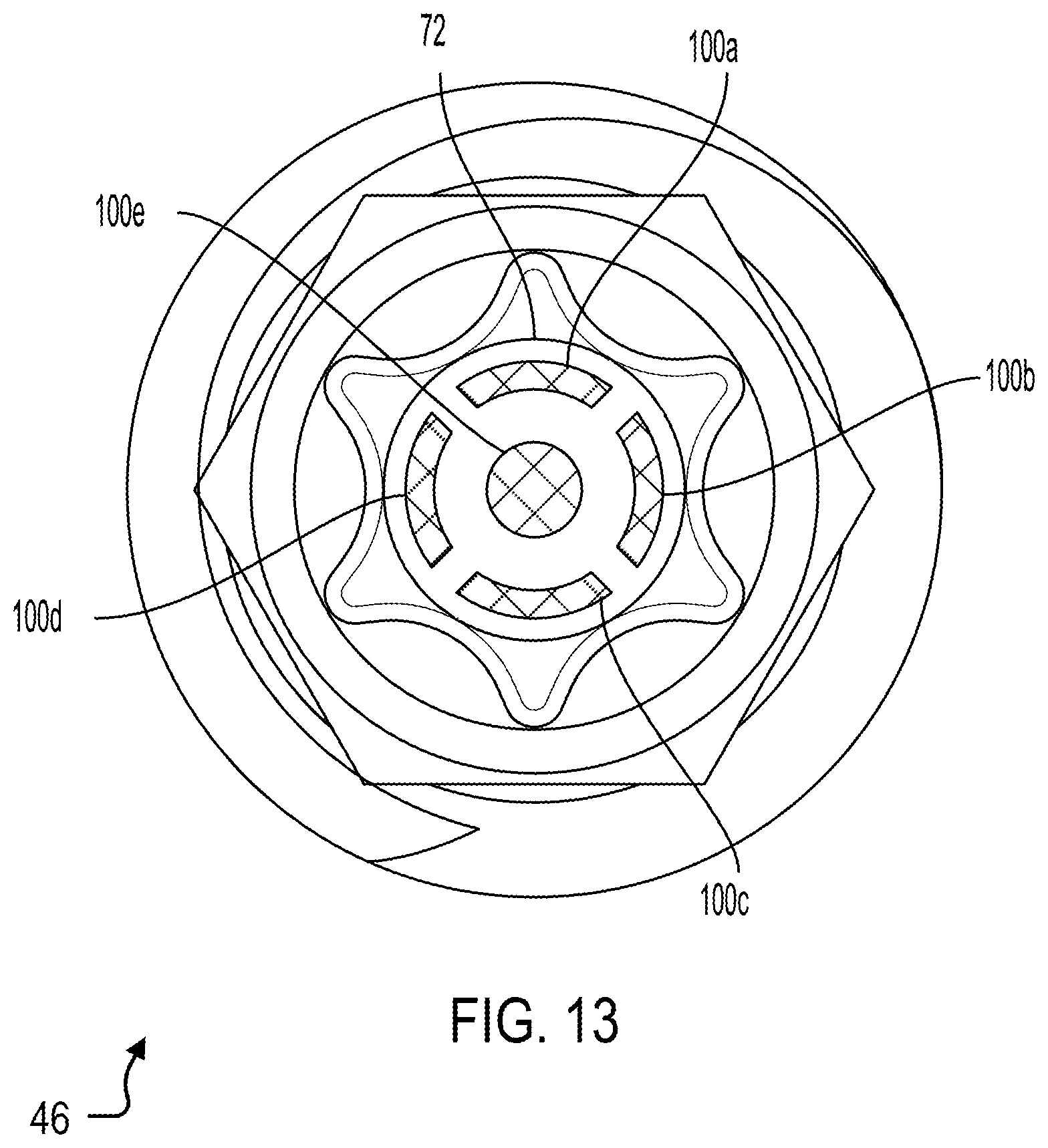 Patent US12508097 Figure 6 – Set screw with strain gauges