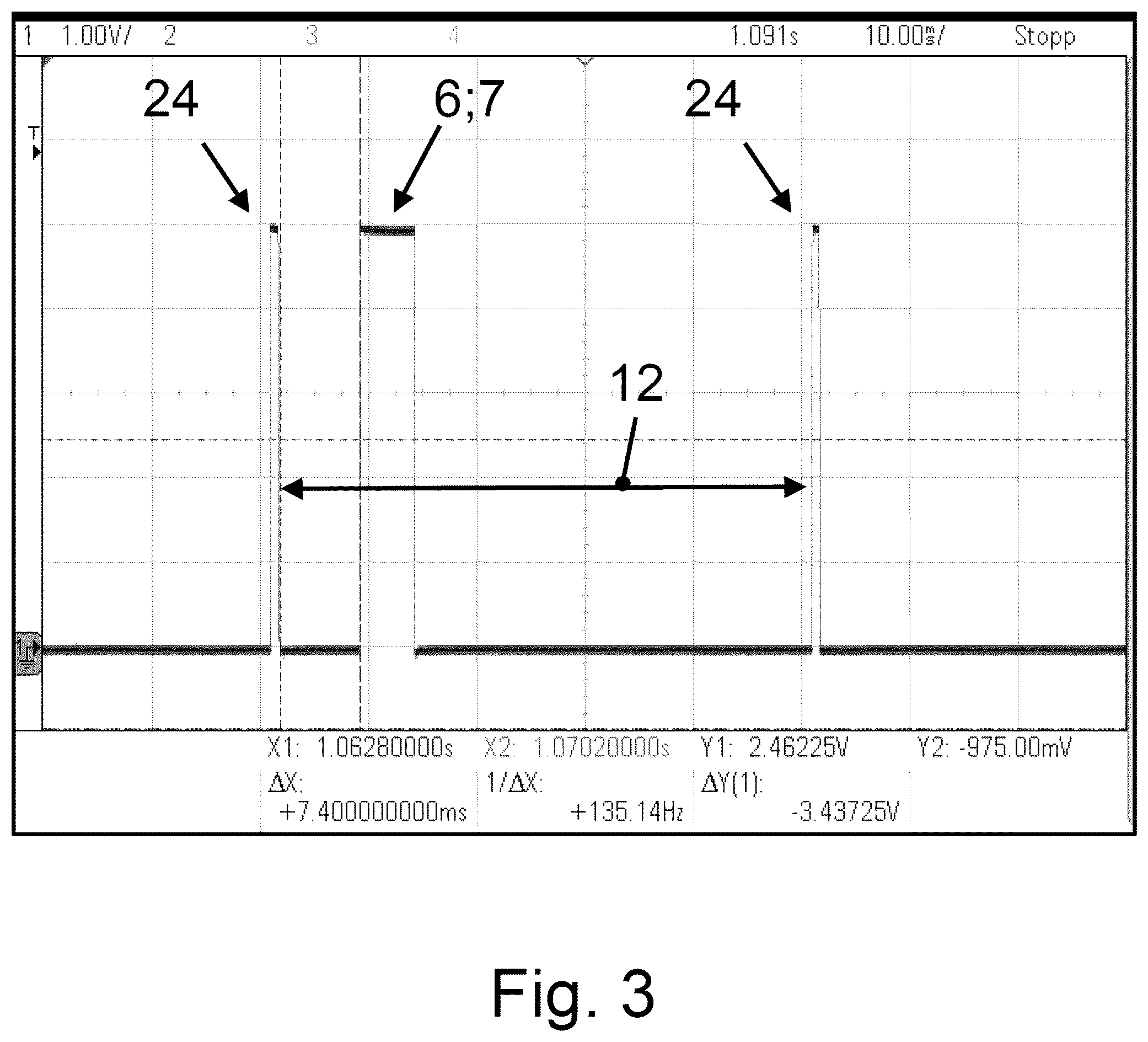 Patent US12508100 Figure 2 – Method for operating a medical optical tracking system, and medical optical tracking system