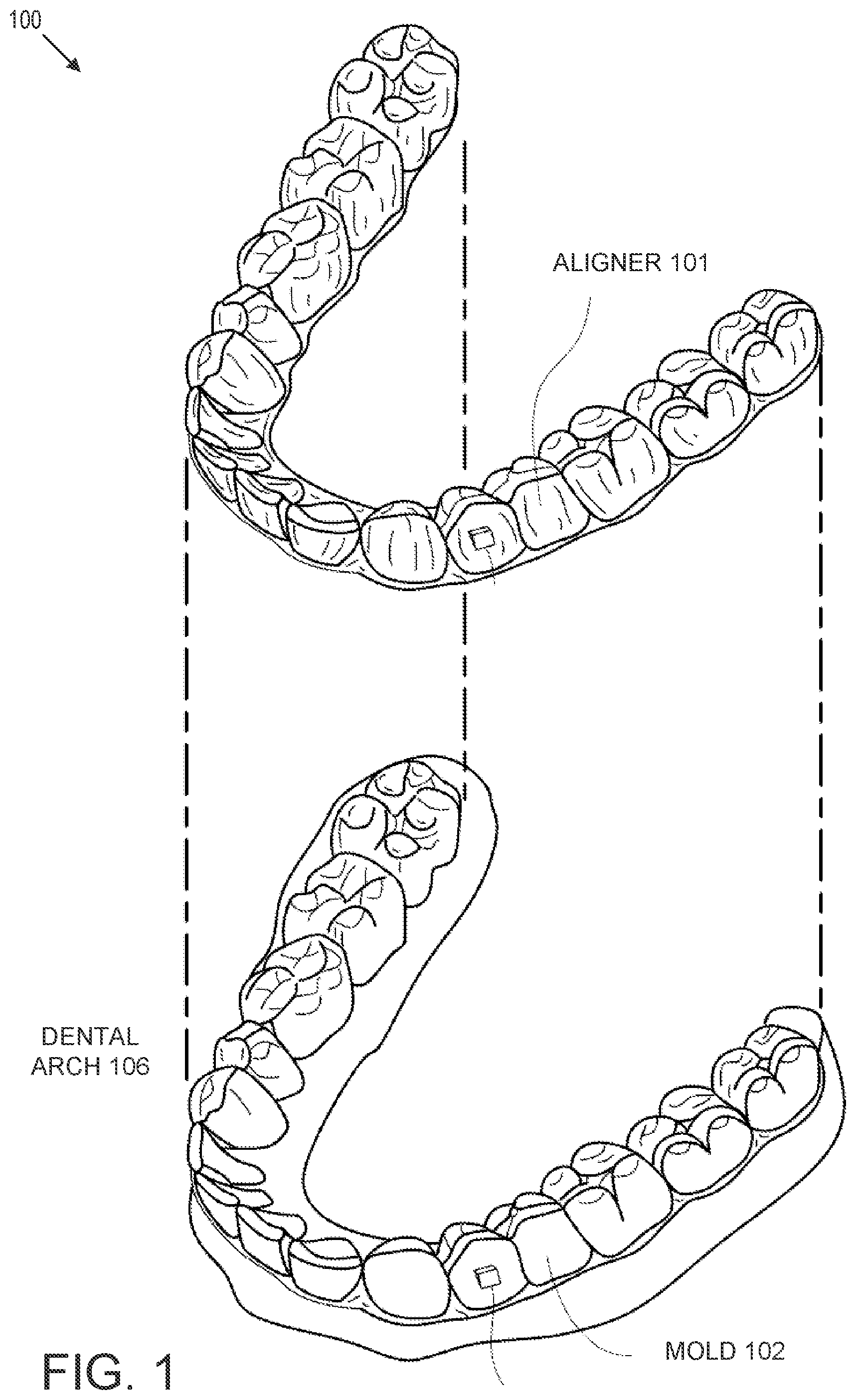 Patent US12508102 — Mold Fabrication using virtual fillers — Figure 1