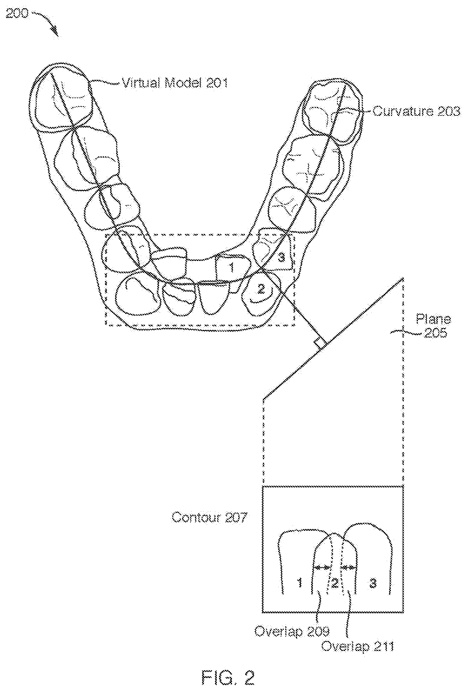 Patent US12508102 Figure 2 – Mold Fabrication using virtual fillers