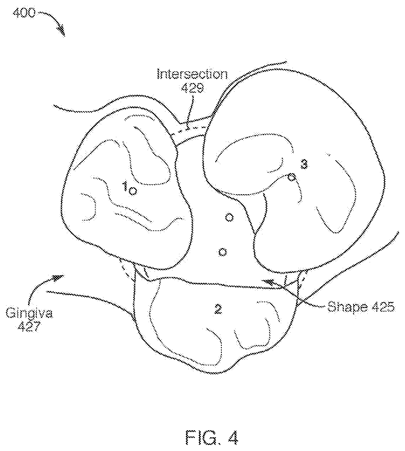Patent US12508102 Figure 4 – Mold Fabrication using virtual fillers