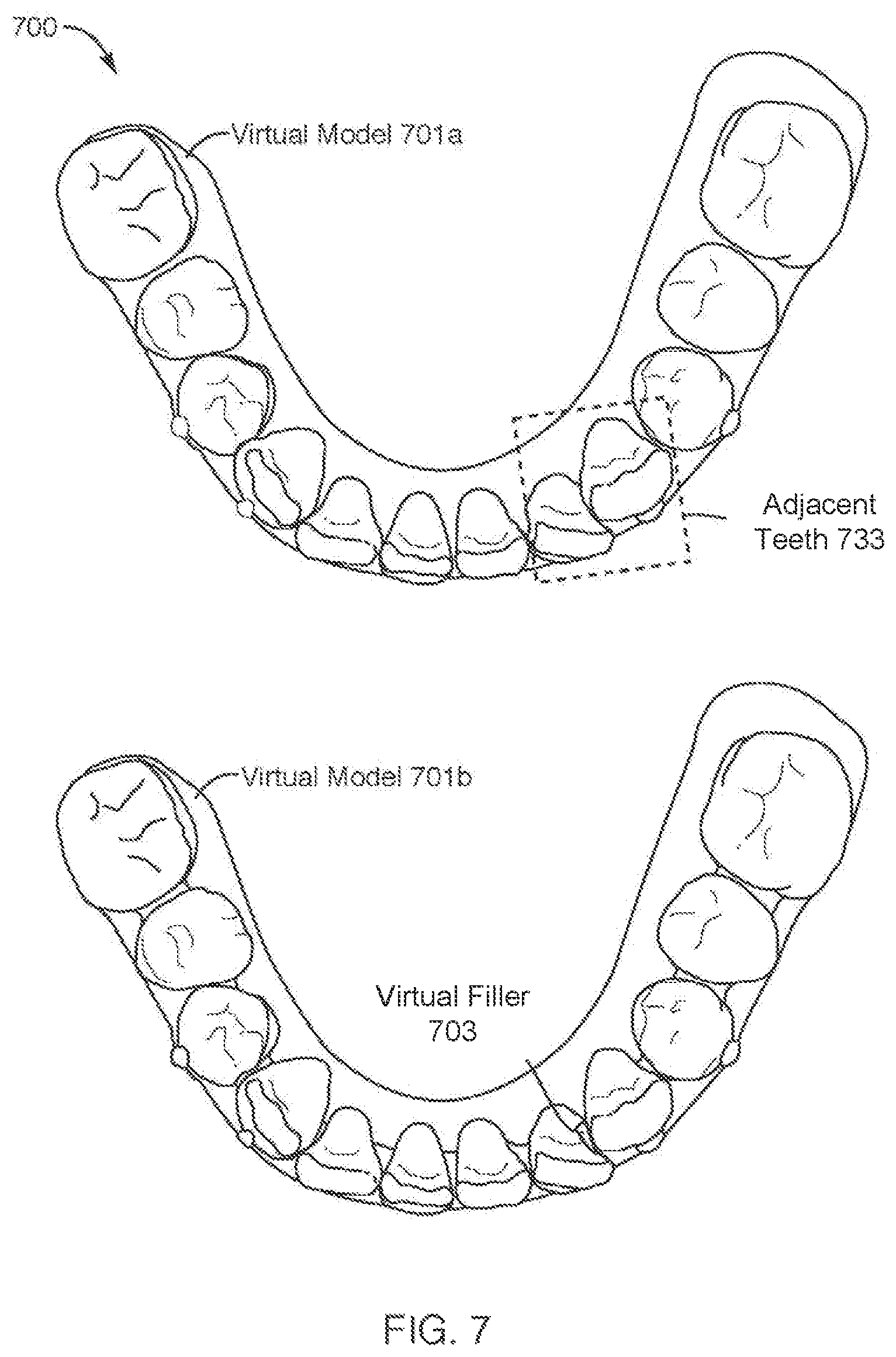 Patent US12508102 Figure 8 – Mold Fabrication using virtual fillers