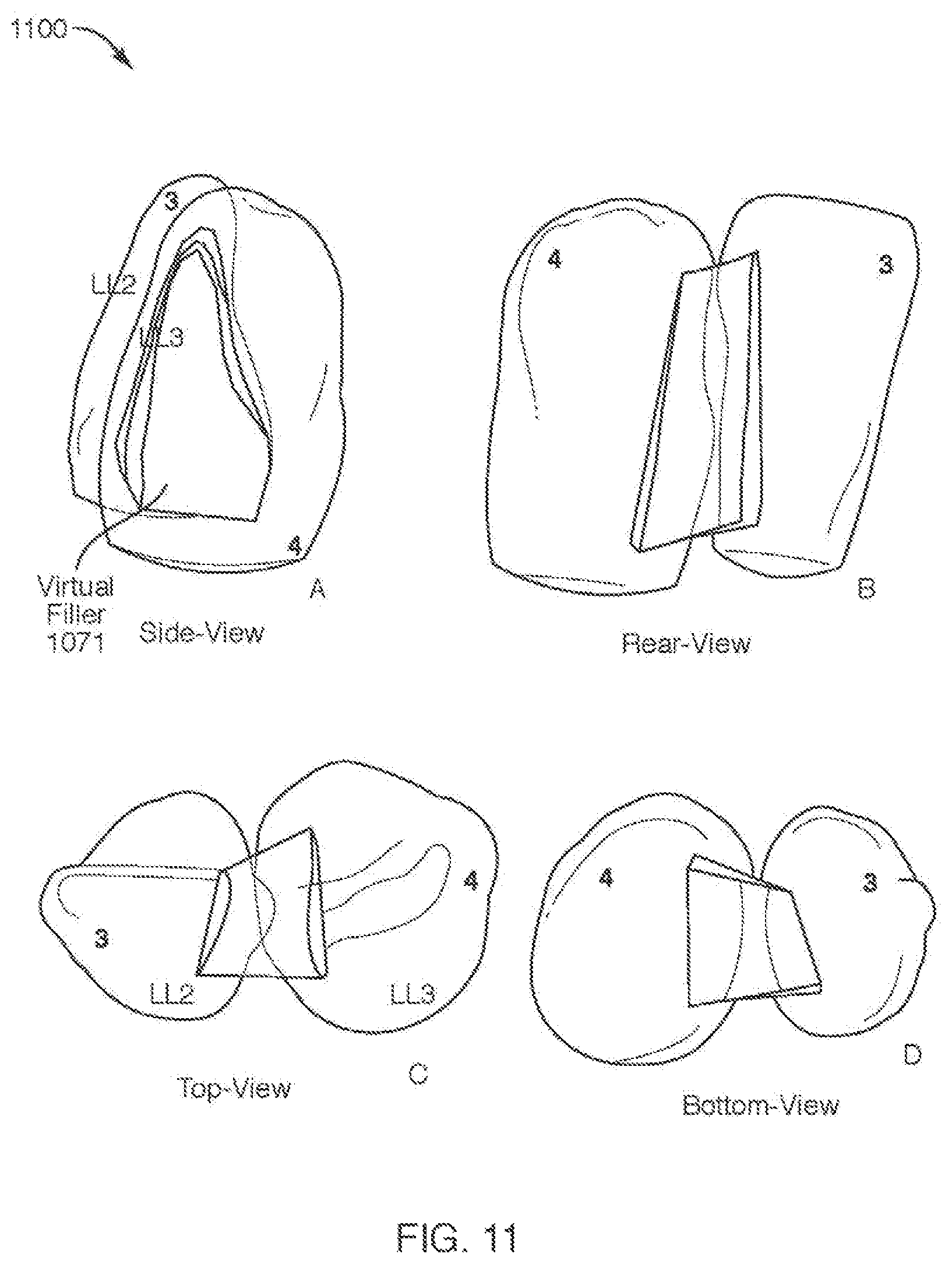 Patent US12508102 Figure 12 – Mold Fabrication using virtual fillers