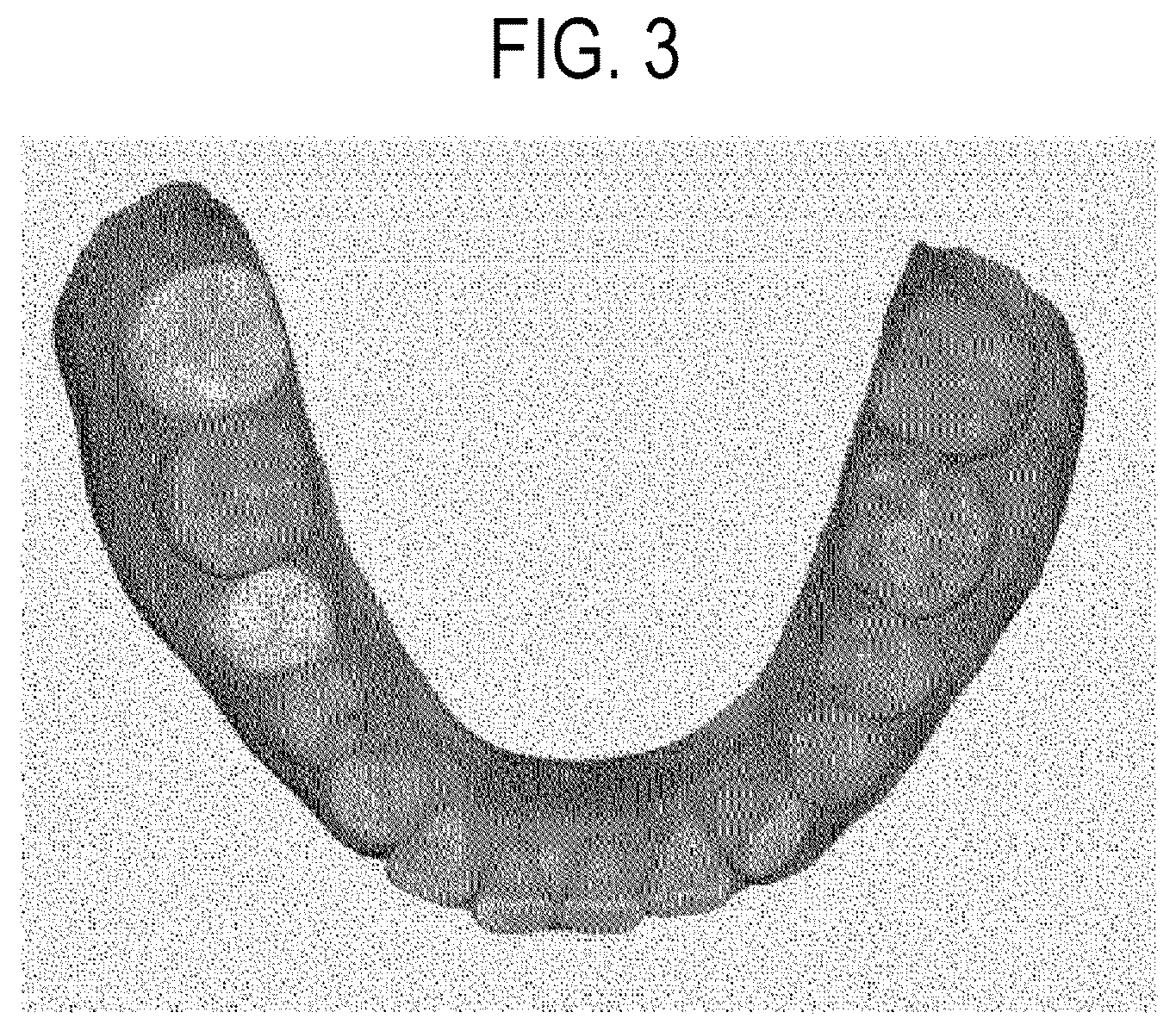 Patent US12508103 Figure 3 – System for displaying orthodontic information of oral cavity