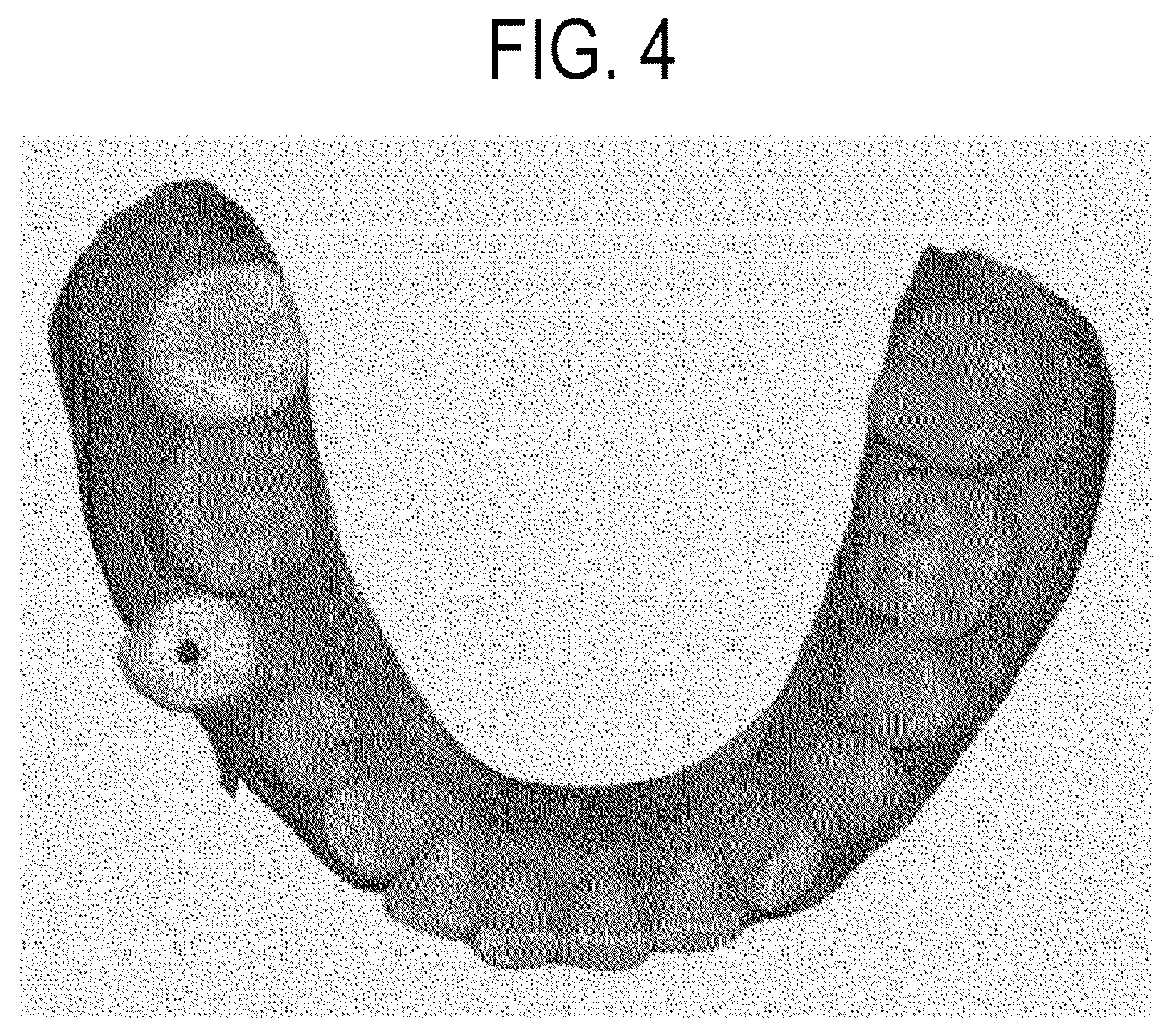 Patent US12508103 Figure 4 – System for displaying orthodontic information of oral cavity