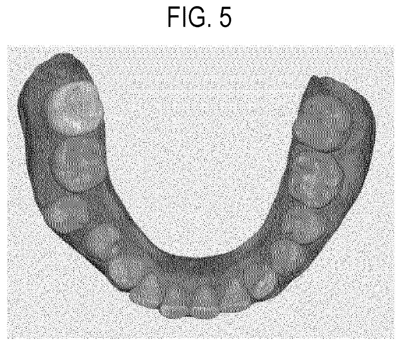 Patent US12508103 Figure 5 – System for displaying orthodontic information of oral cavity