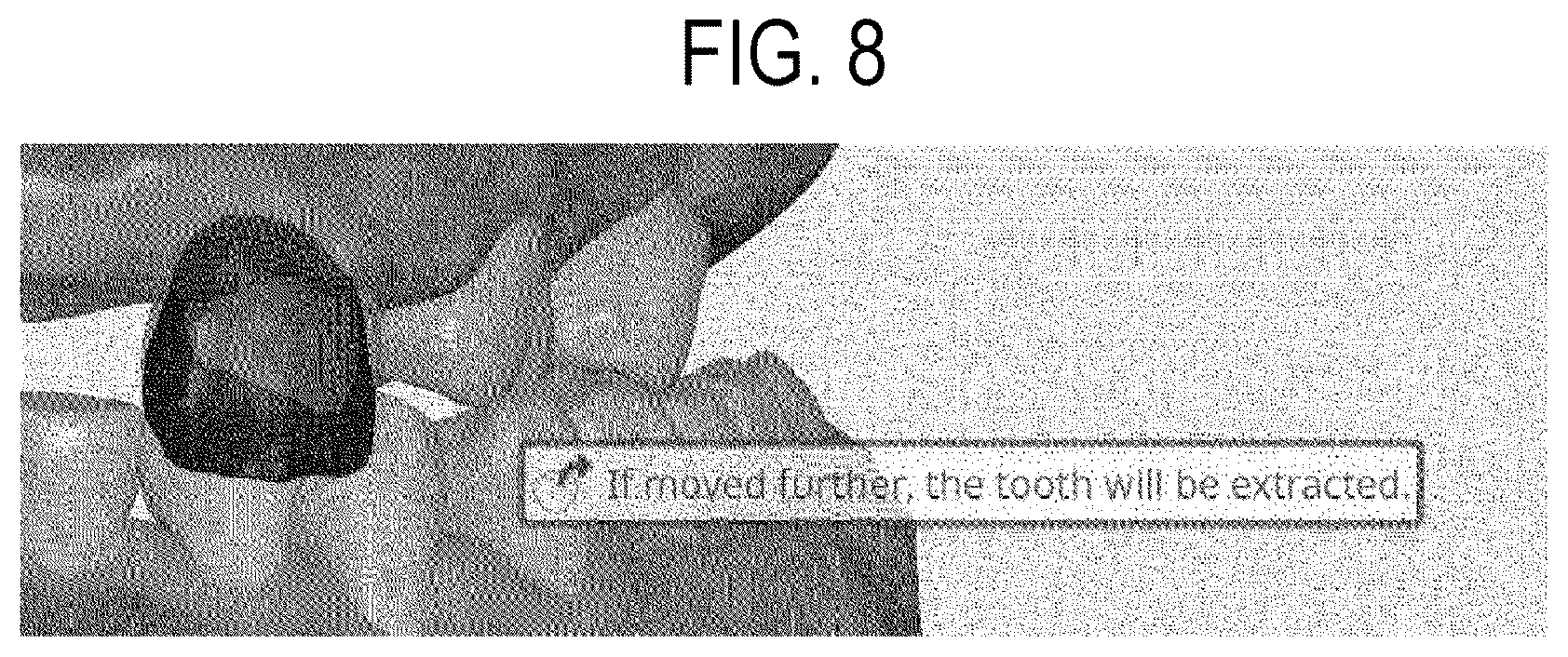 Patent US12508103 Figure 8 – System for displaying orthodontic information of oral cavity