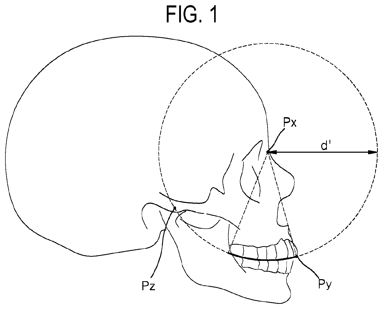 Patent US12508104 — Method for optimizing archline and apparatus using same — Figure 1