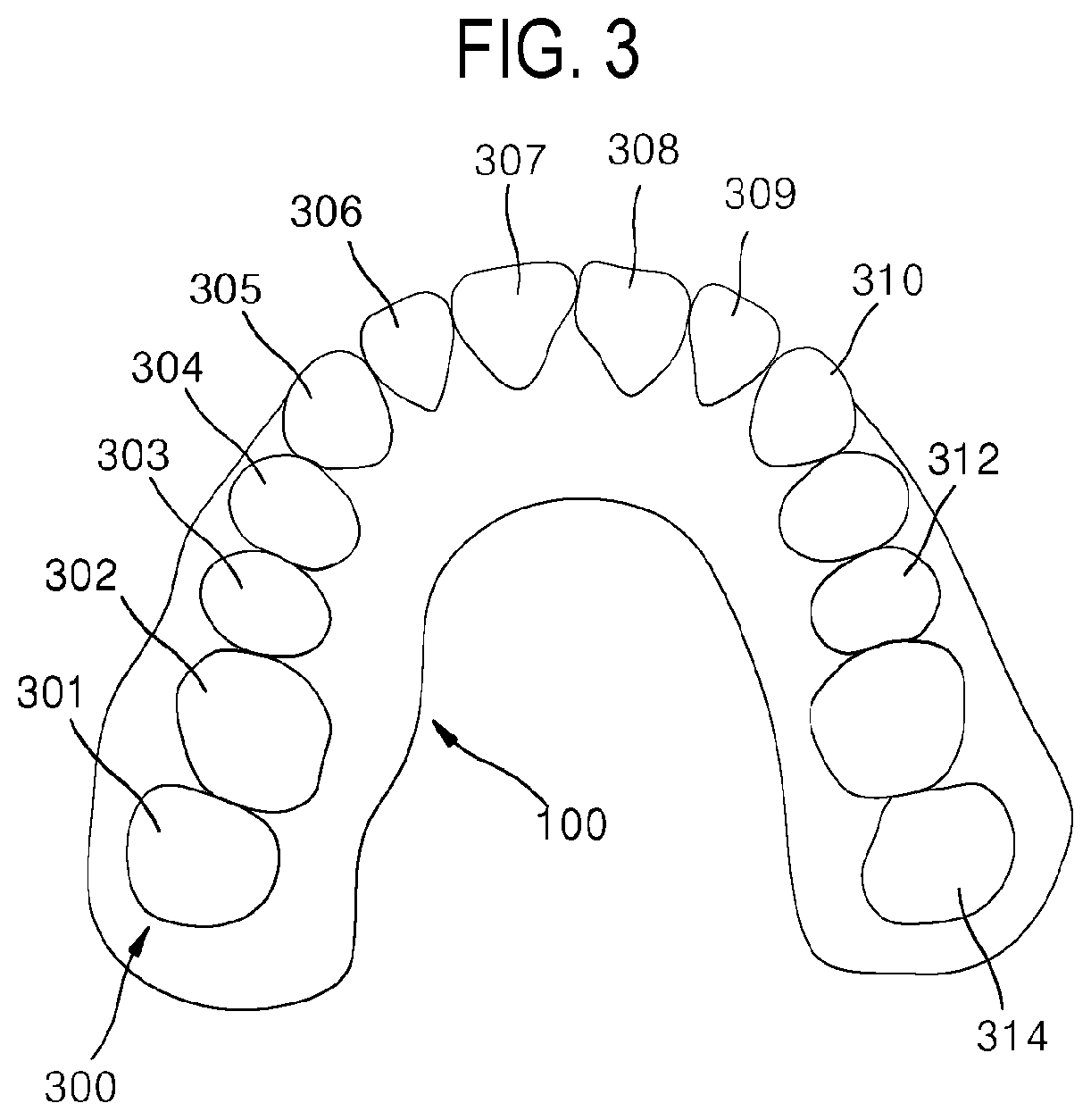 Patent US12508104 Figure 3 – Method for optimizing archline and apparatus using same