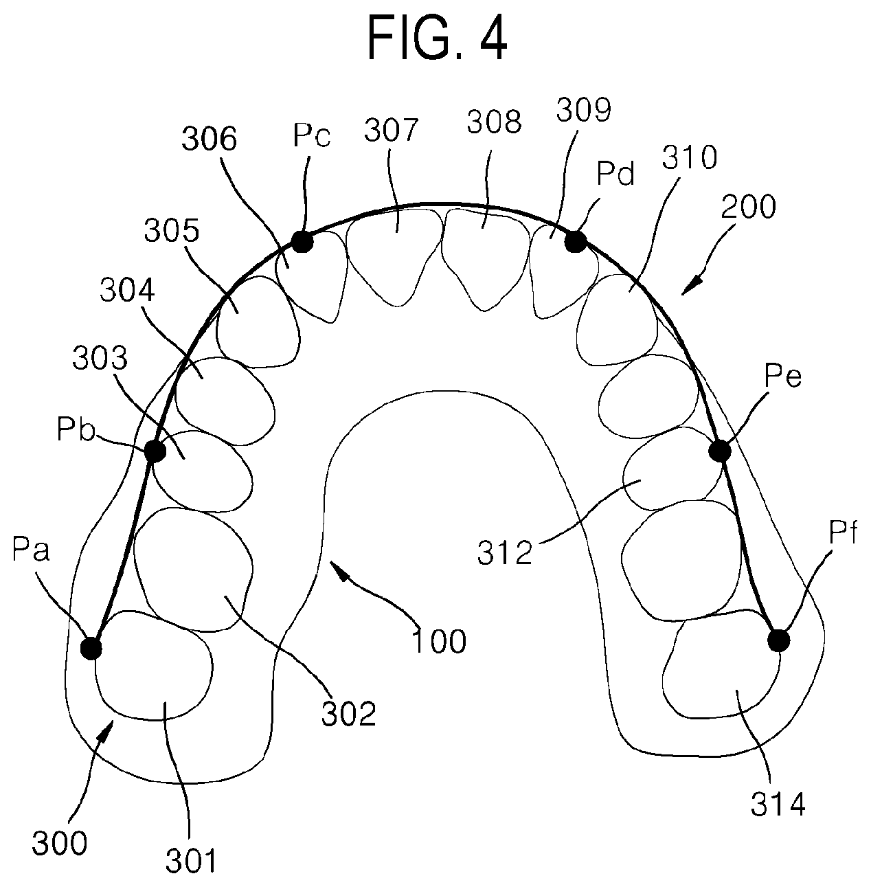 Patent US12508104 Figure 4 – Method for optimizing archline and apparatus using same