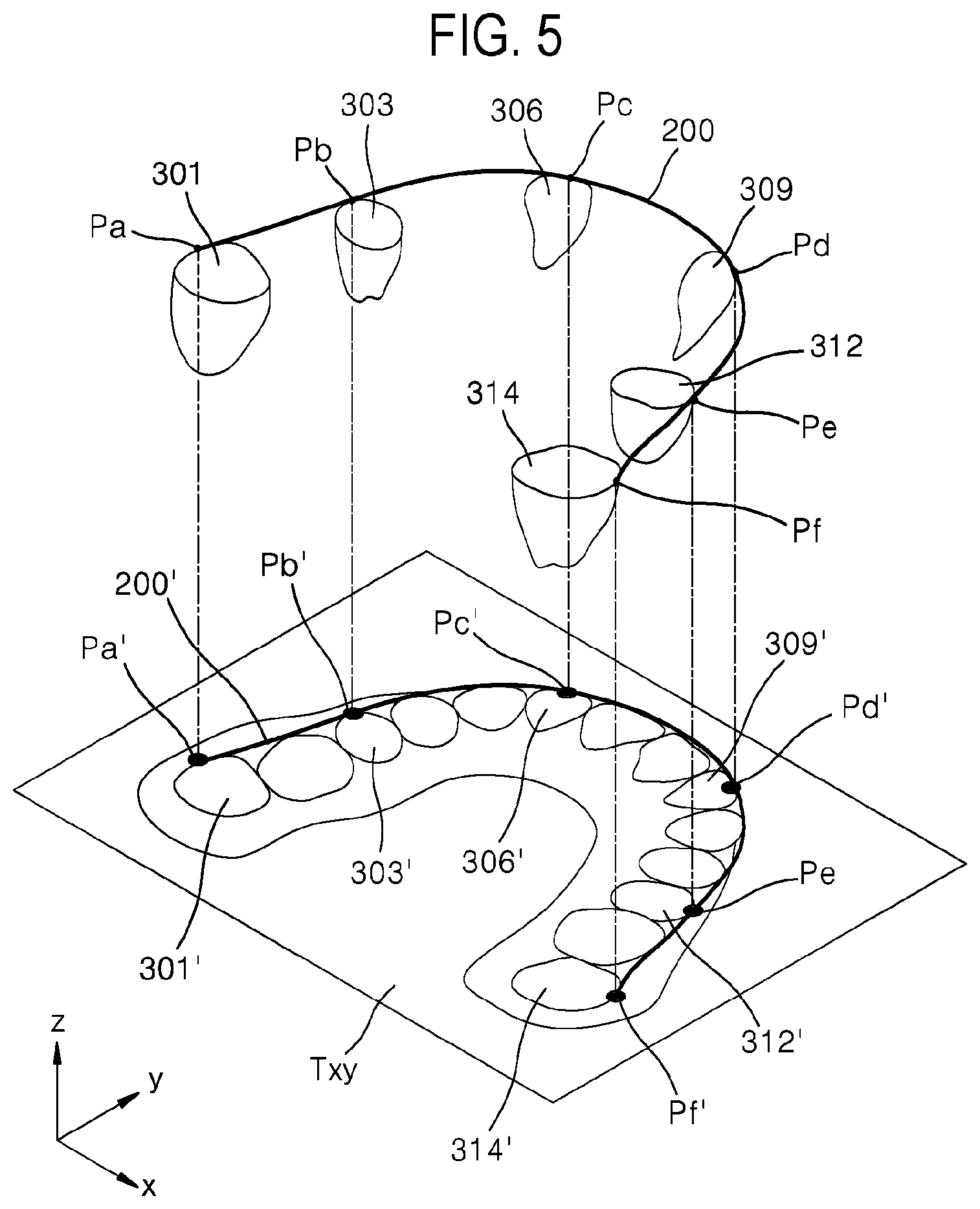 Patent US12508104 Figure 5 – Method for optimizing archline and apparatus using same