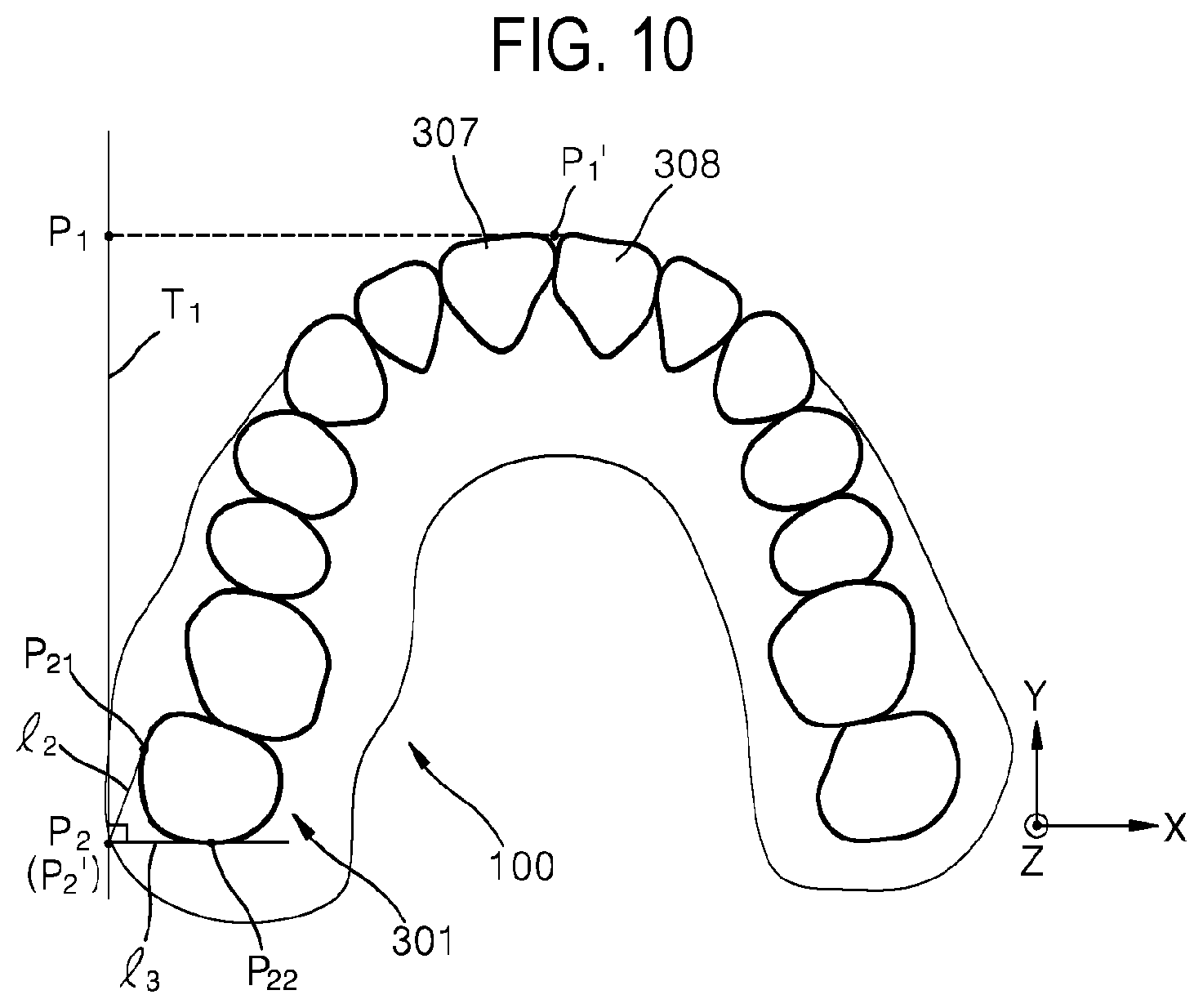 Patent US12508104 Figure 10 – Method for optimizing archline and apparatus using same