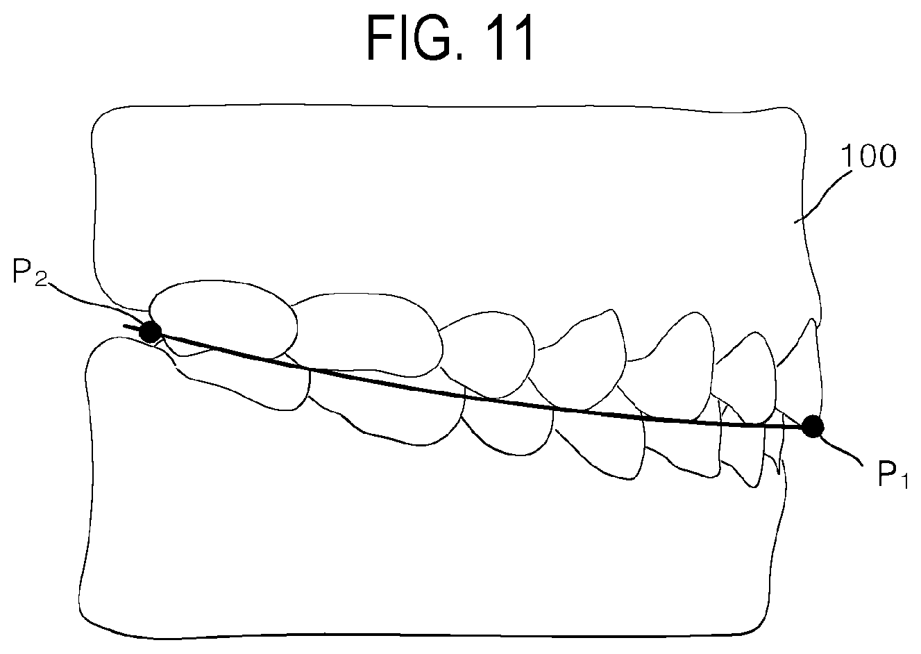 Patent US12508104 Figure 11 – Method for optimizing archline and apparatus using same