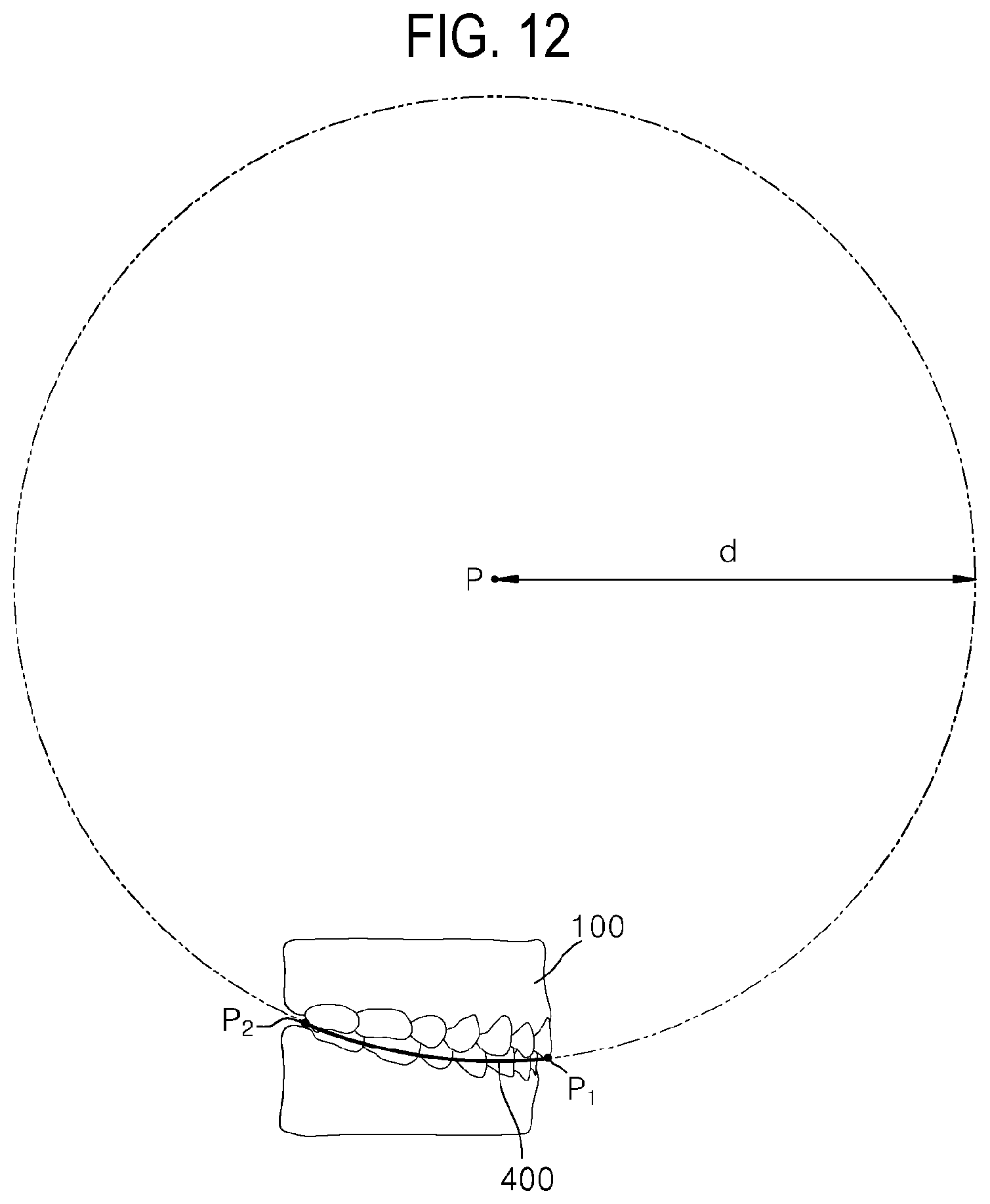 Patent US12508104 Figure 12 – Method for optimizing archline and apparatus using same