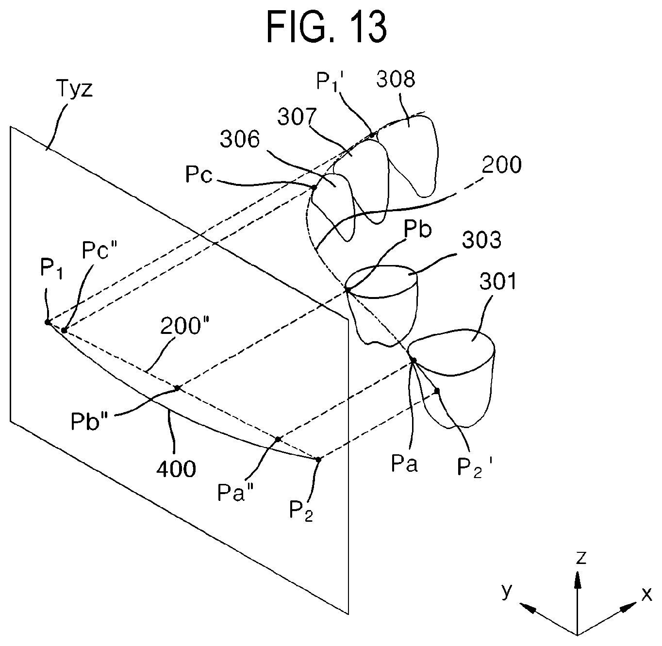 Patent US12508104 Figure 13 – Method for optimizing archline and apparatus using same