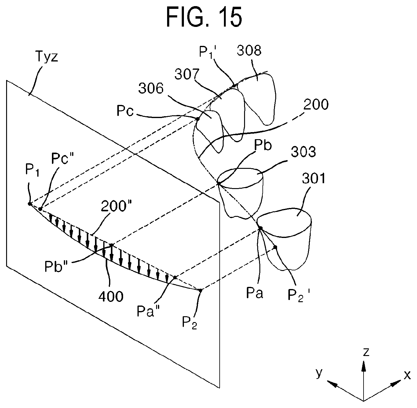 Patent US12508104 Figure 15 – Method for optimizing archline and apparatus using same