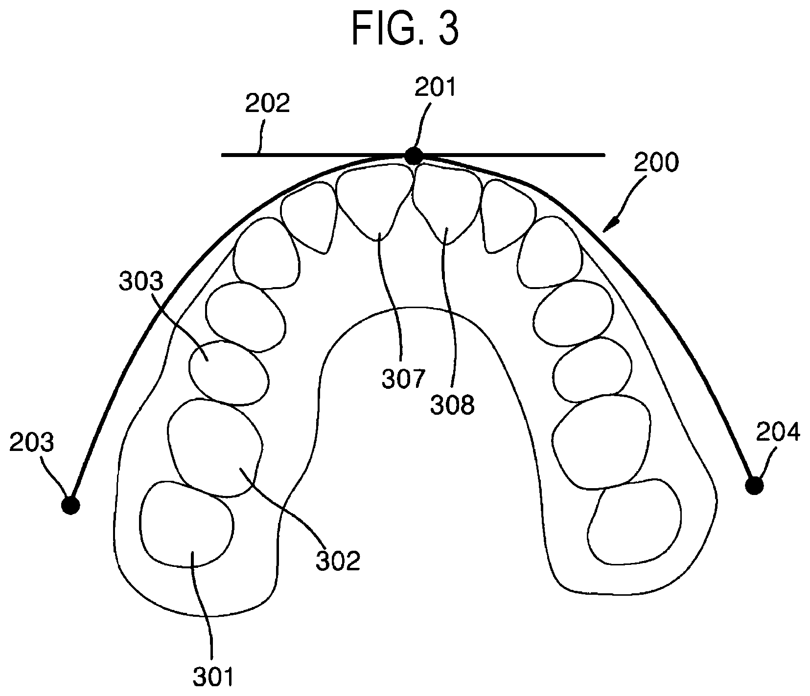 Patent US12508105 Figure 3 – Data processing method and data processing device