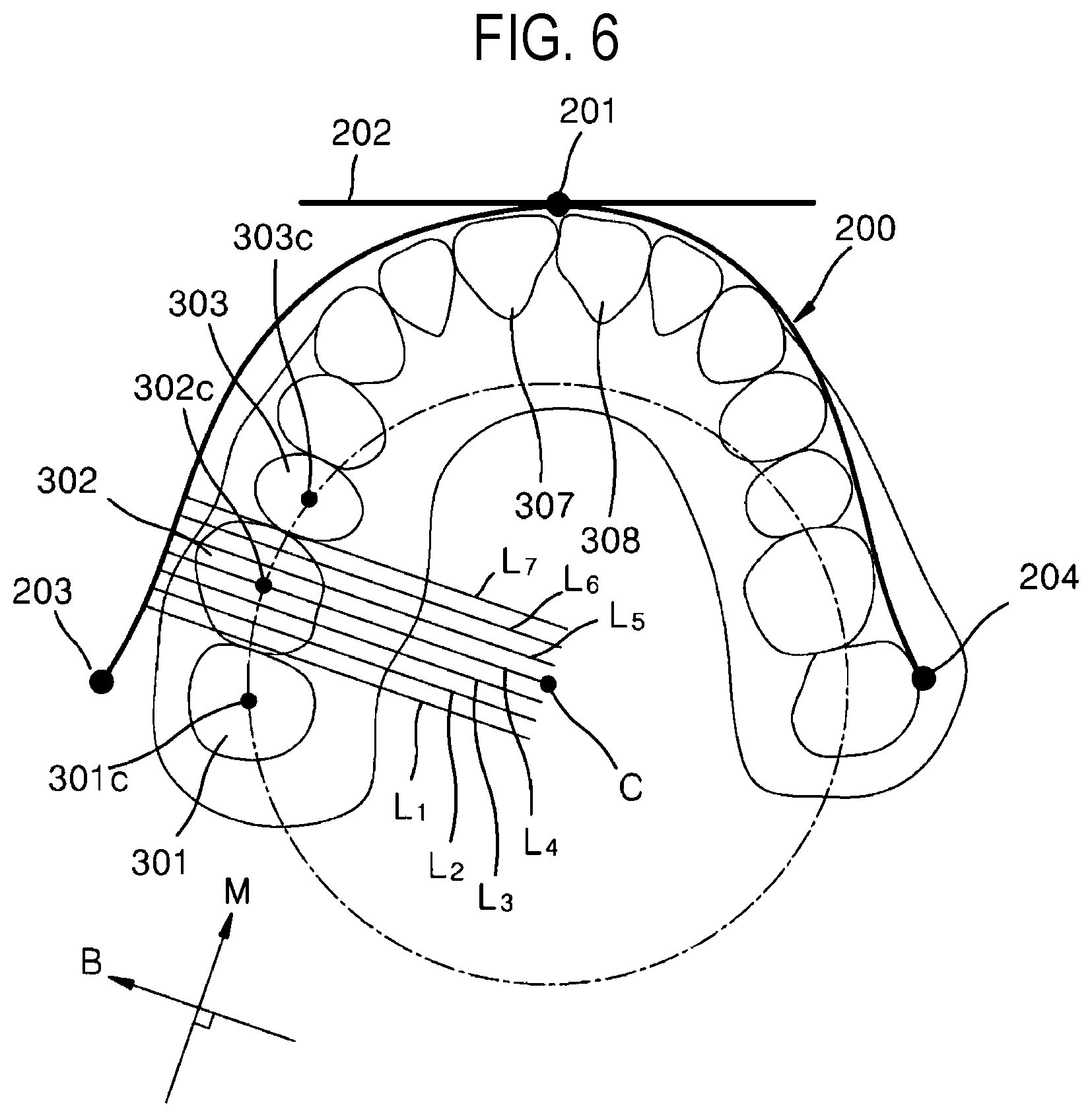 Patent US12508105 Figure 6 – Data processing method and data processing device