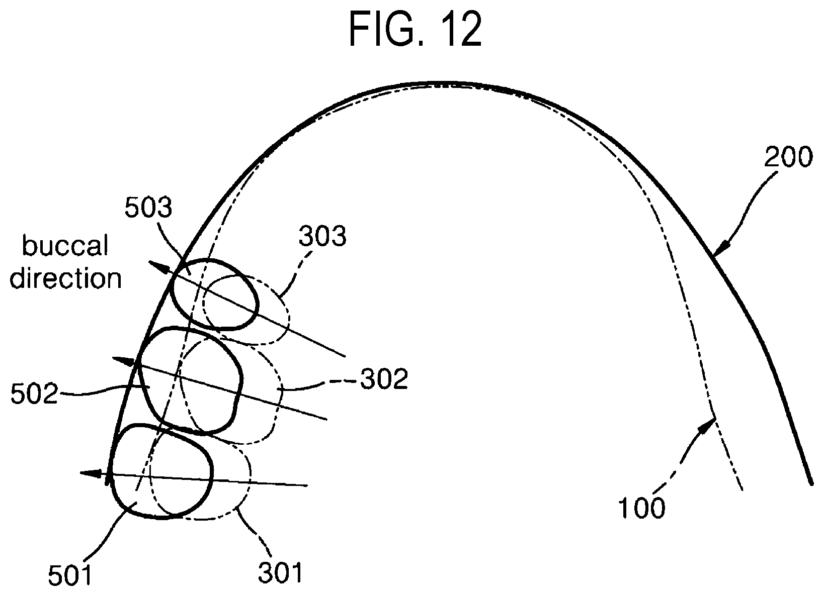 Patent US12508105 Figure 12 – Data processing method and data processing device