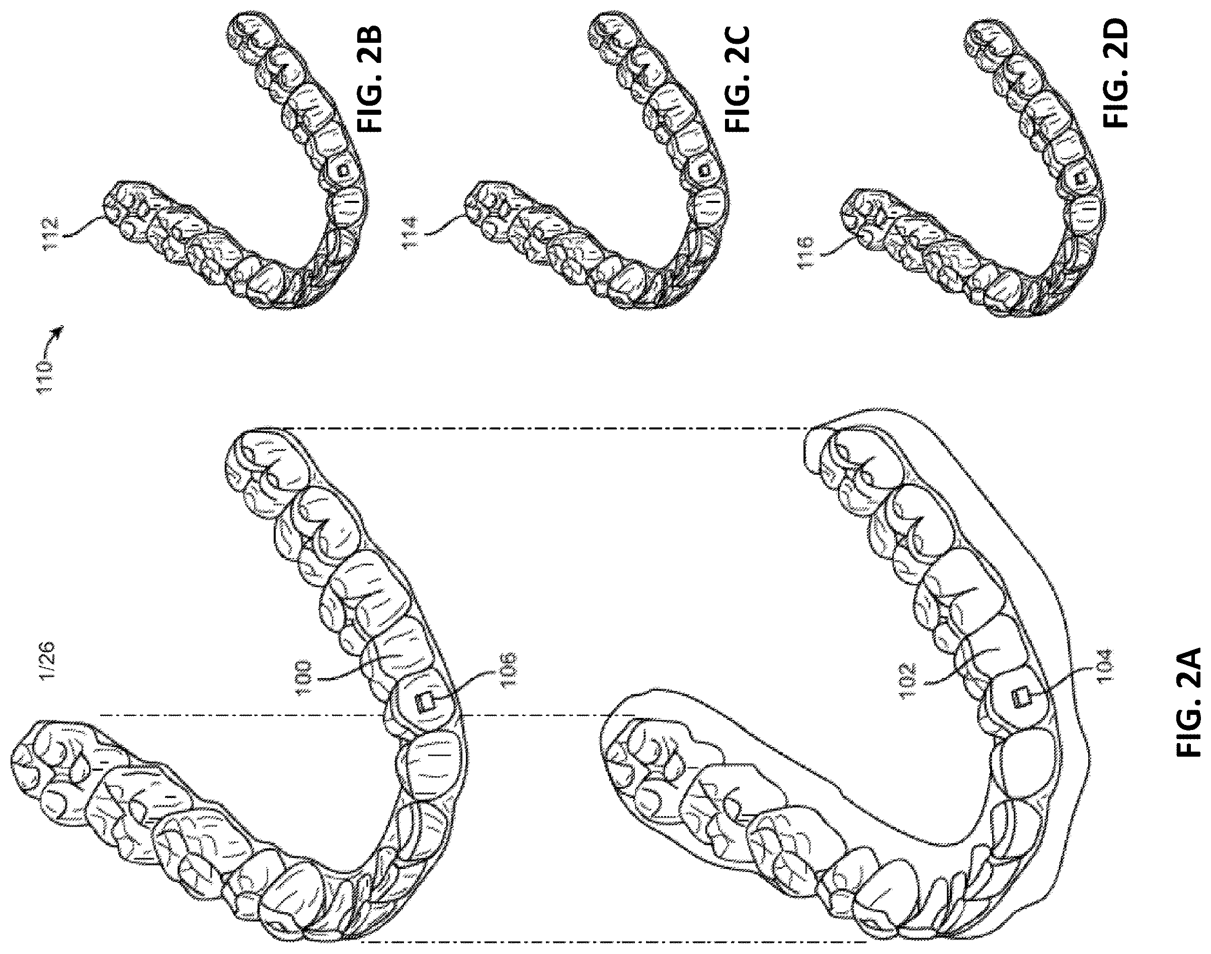 Patent US12508106 Figure 5 – Systems and methods for monitoring orthodontic treatment